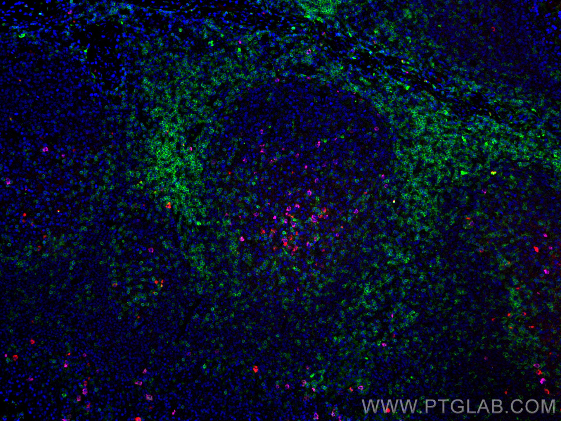 Immunofluorescence (IF) / fluorescent staining of human tonsillitis tissue using CoraLite® Plus 488-conjugated CD3 Monoclonal antib (CL488-60181)