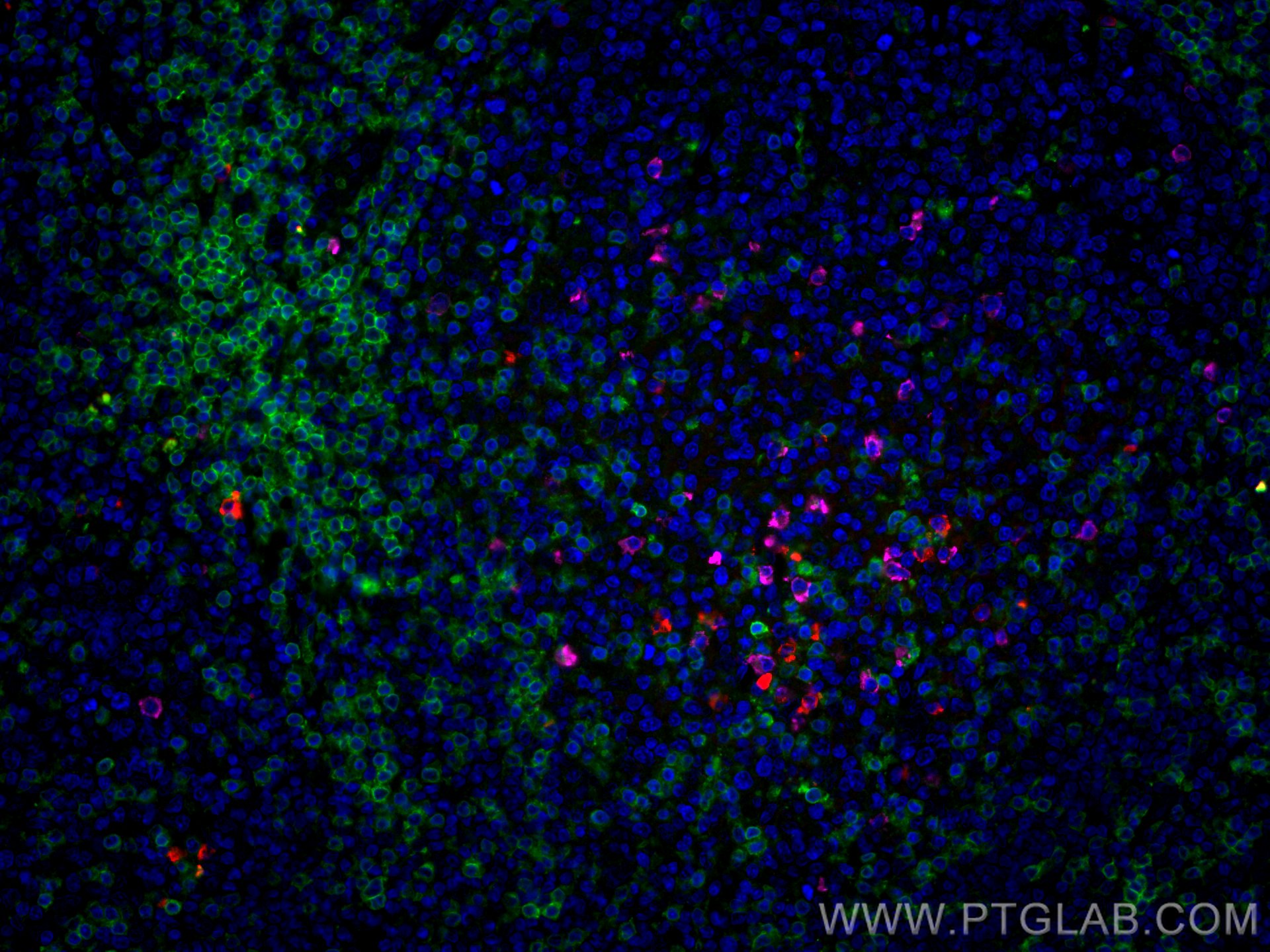 Immunofluorescence (IF) / fluorescent staining of human tonsillitis tissue using CoraLite® Plus 488-conjugated CD3 Monoclonal antib (CL488-60181)