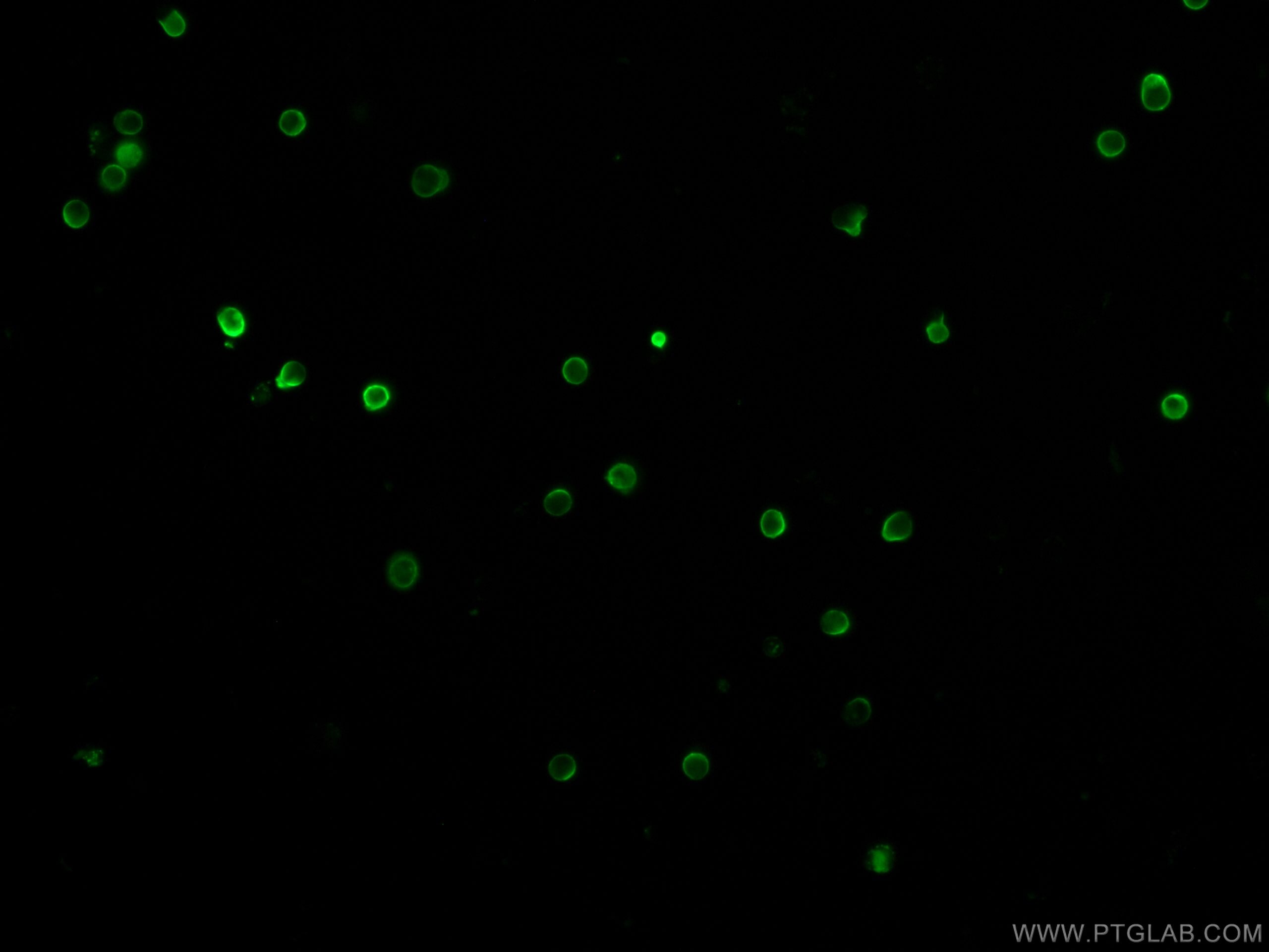 IF Staining of mouse splenocytes using CL488-65077