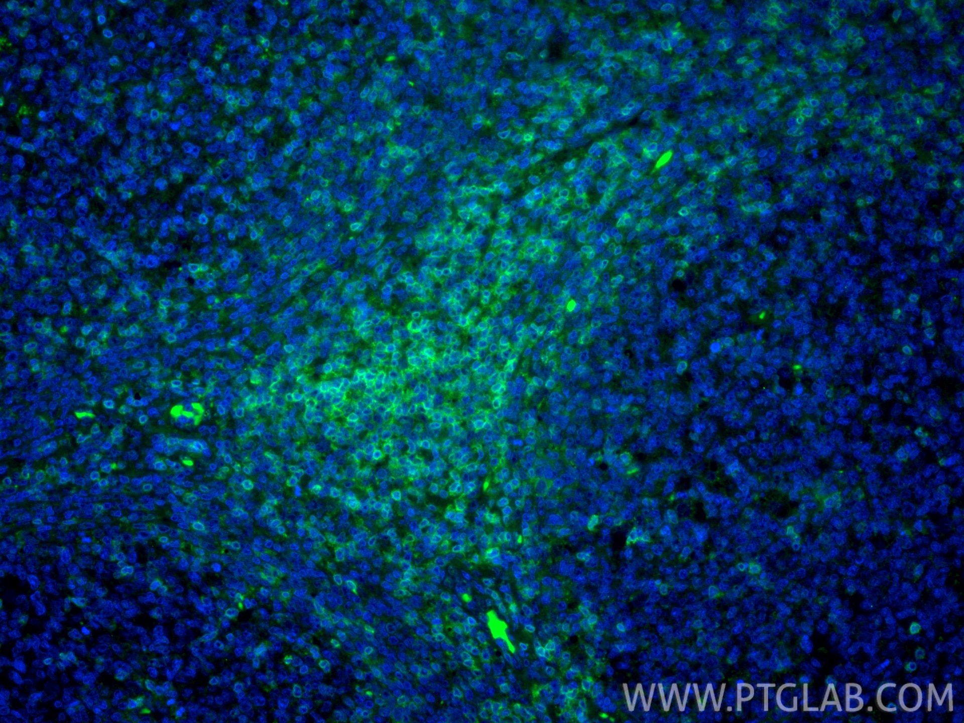 Immunofluorescence (IF) / fluorescent staining of human tonsillitis tissue using CoraLite® Plus 488-conjugated CD3 Recombinant mono (CL488-81324)
