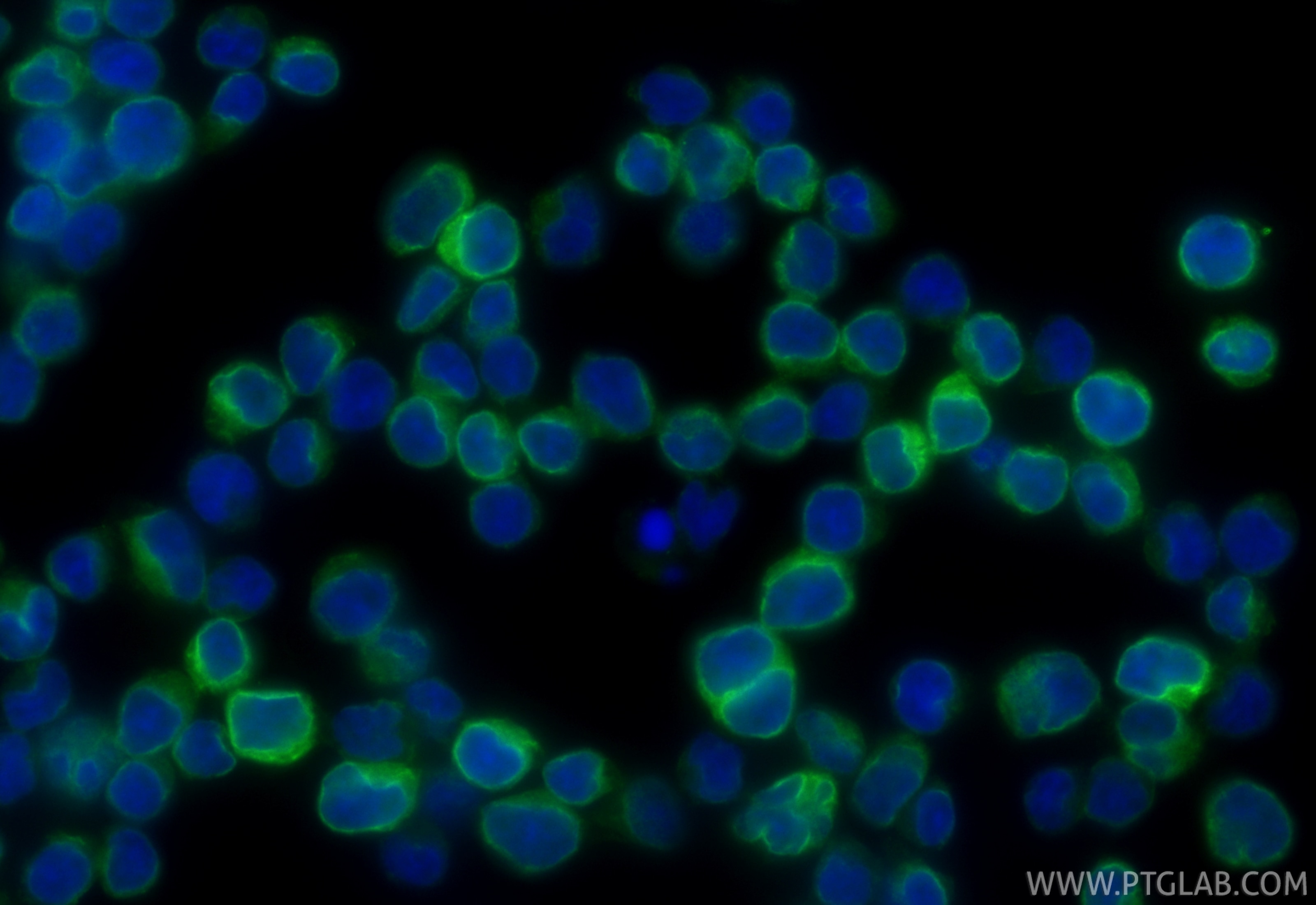 Immunofluorescence (IF) / fluorescent staining of Jurkat cells using CoraLite® Plus 488-conjugated CD3 Recombinant mono (CL488-84505-4)