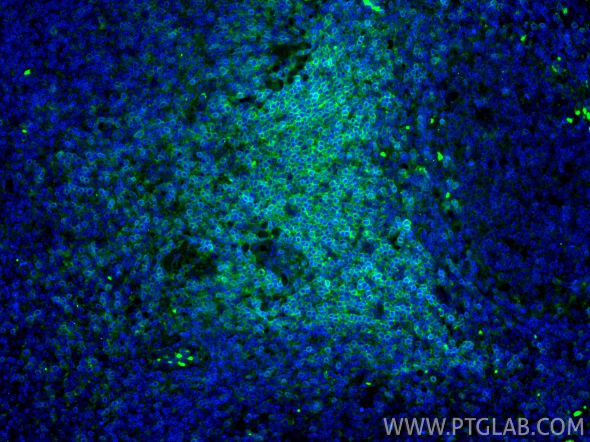 Immunofluorescence (IF) / fluorescent staining of human tonsillitis tissue using CoraLite® Plus 488-conjugated CD3 Recombinant mono (CL488-84505-4)