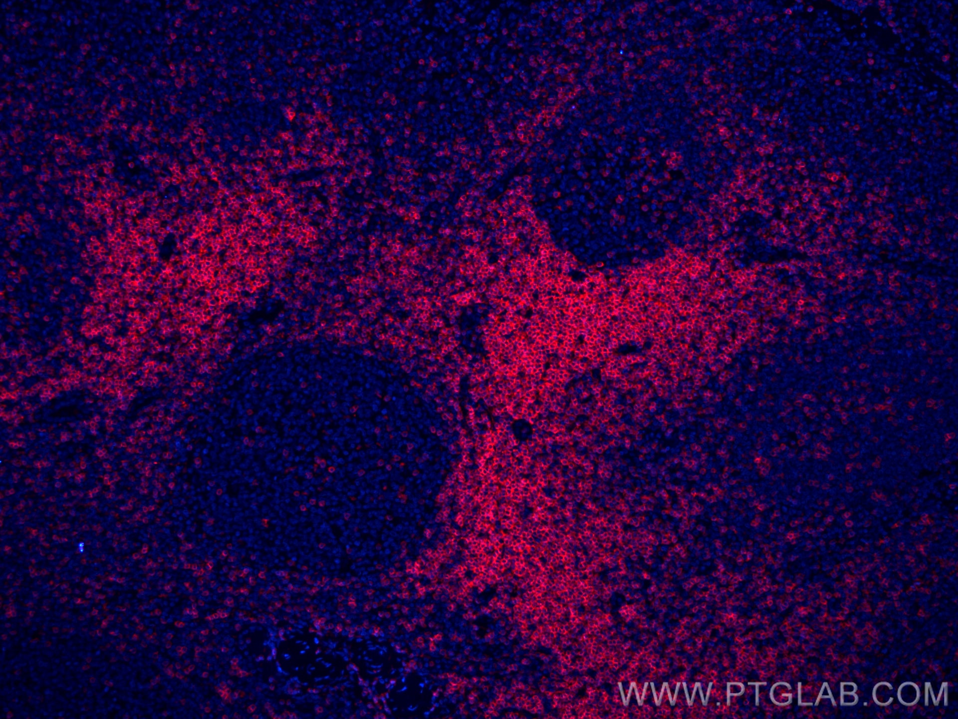 Immunofluorescence (IF) / fluorescent staining of human tonsillitis tissue using CoraLite®594-conjugated CD3 Monoclonal antibody (CL594-60181)