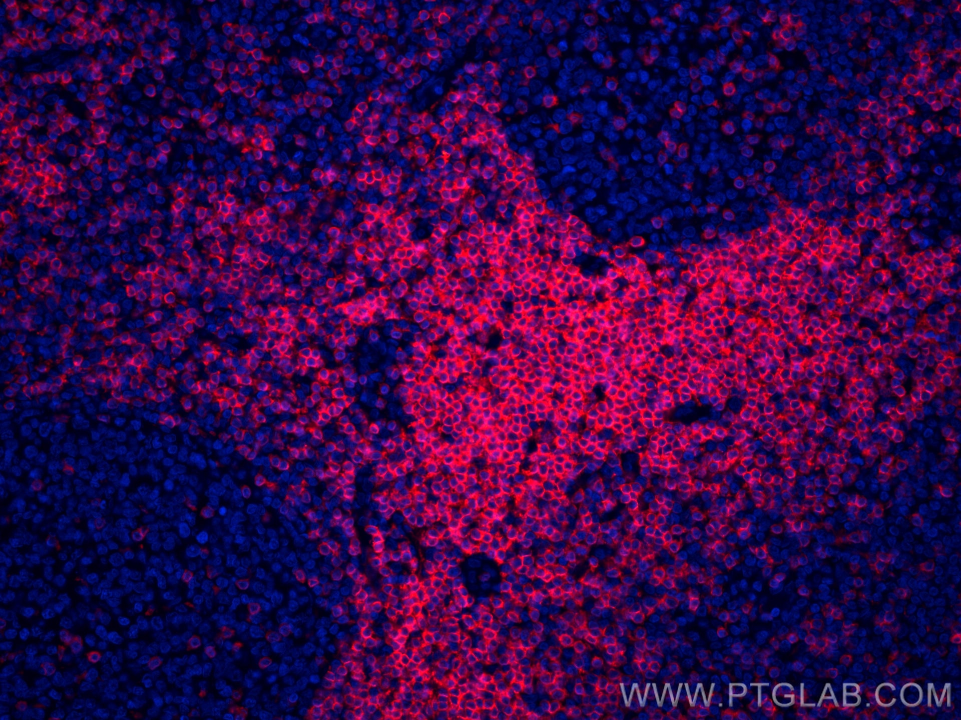 Immunofluorescence (IF) / fluorescent staining of human tonsillitis tissue using CoraLite®594-conjugated CD3 Monoclonal antibody (CL594-60181)