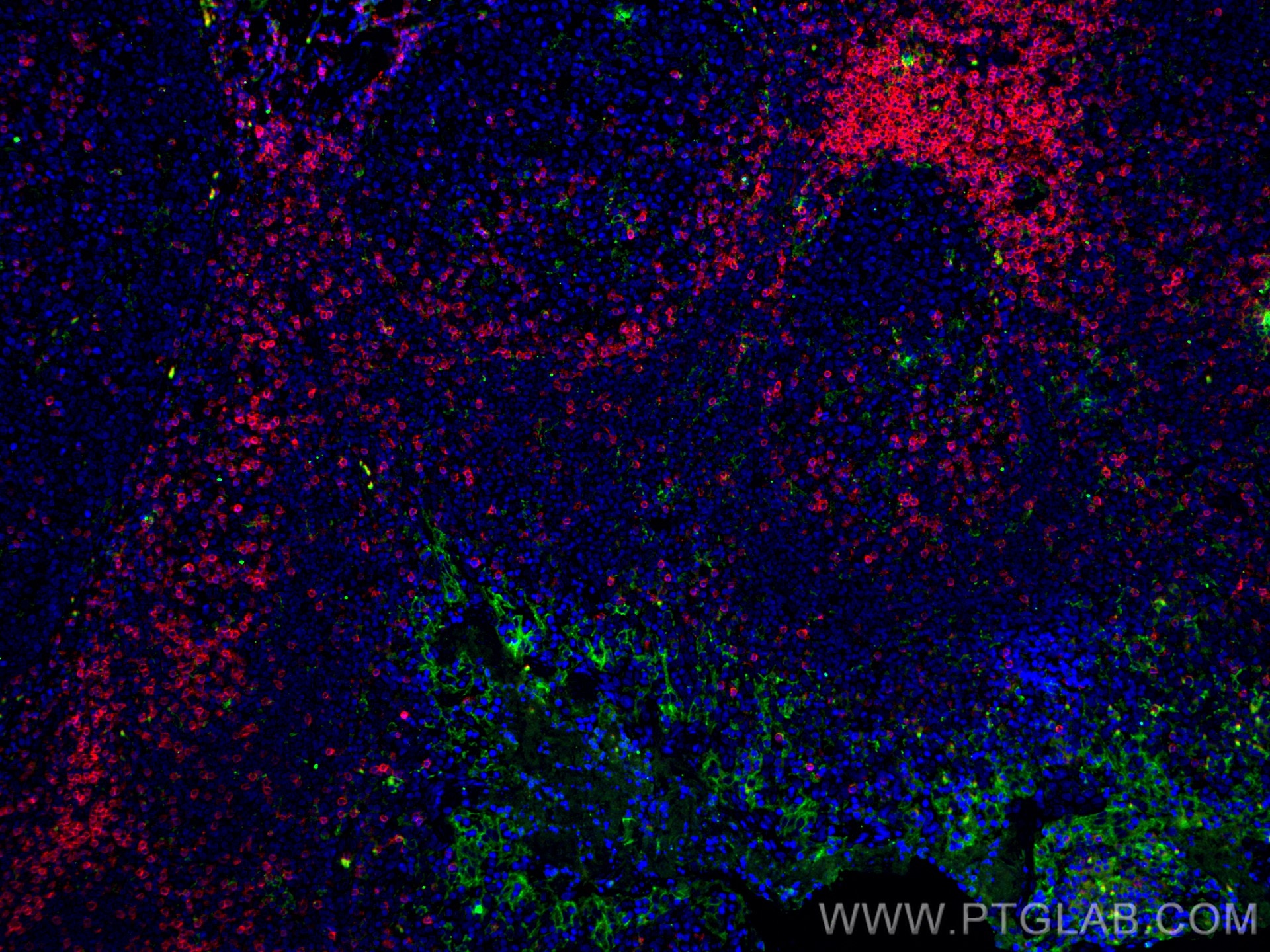 Immunofluorescence (IF) / fluorescent staining of human tonsillitis tissue using CoraLite®594-conjugated CD3 Monoclonal antibody (CL594-60181)