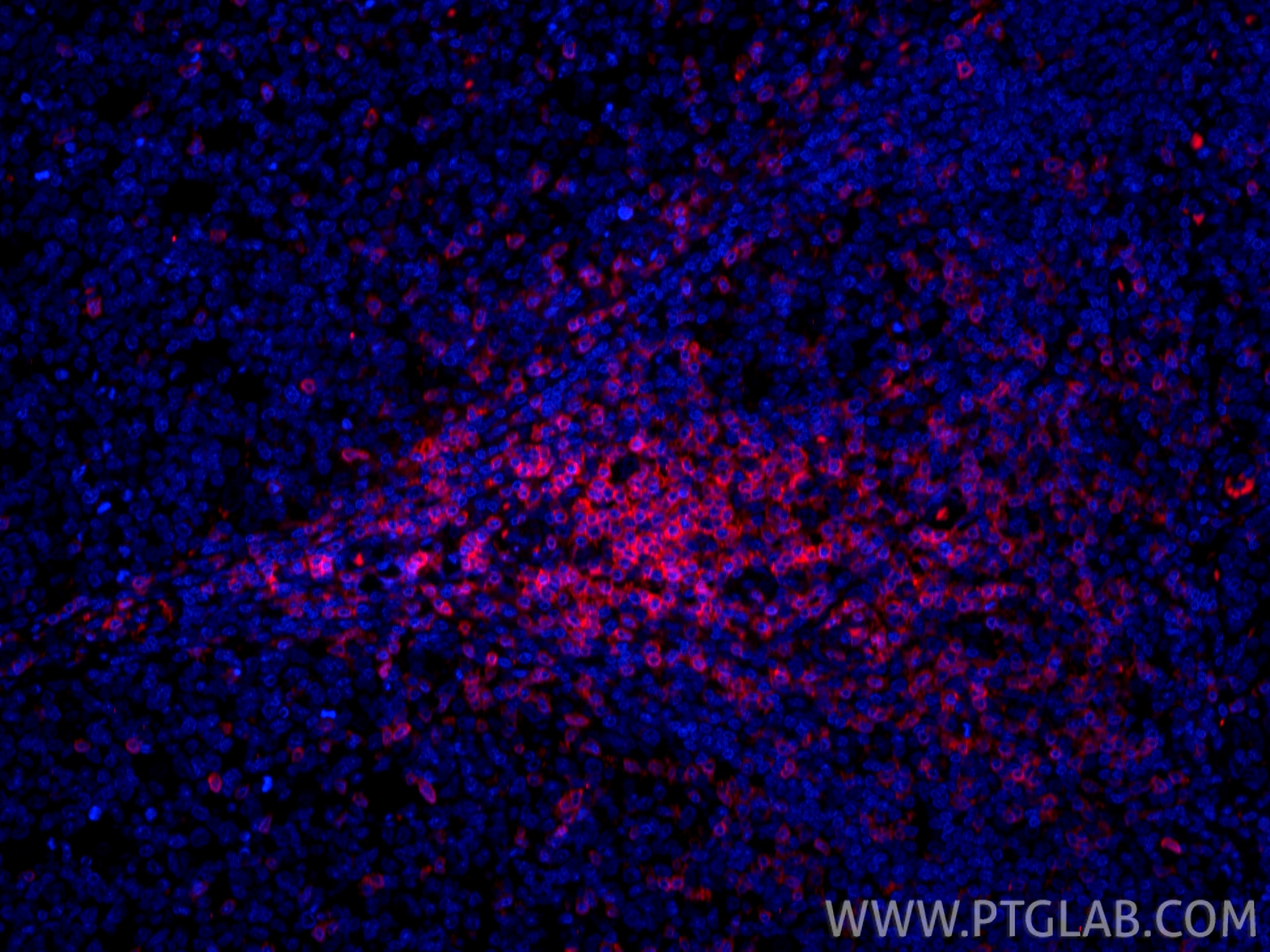 Immunofluorescence (IF) / fluorescent staining of human tonsillitis tissue using CoraLite®594-conjugated CD3 Recombinant monoclonal (CL594-84505-4)