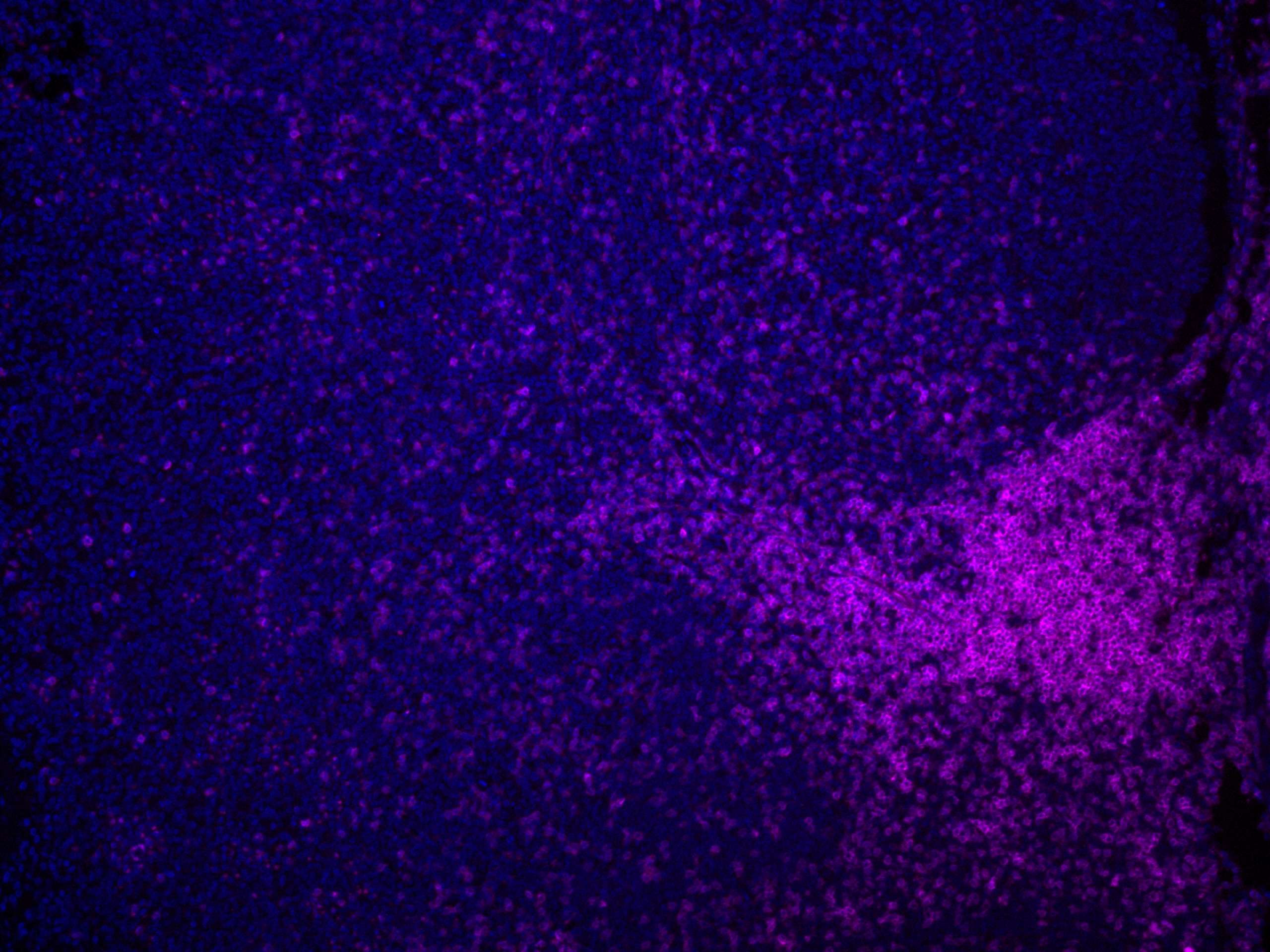 Immunofluorescence (IF) / fluorescent staining of human tonsillitis tissue using CoraLite® Plus 647-conjugated CD3 Monoclonal antib (CL647-60181)