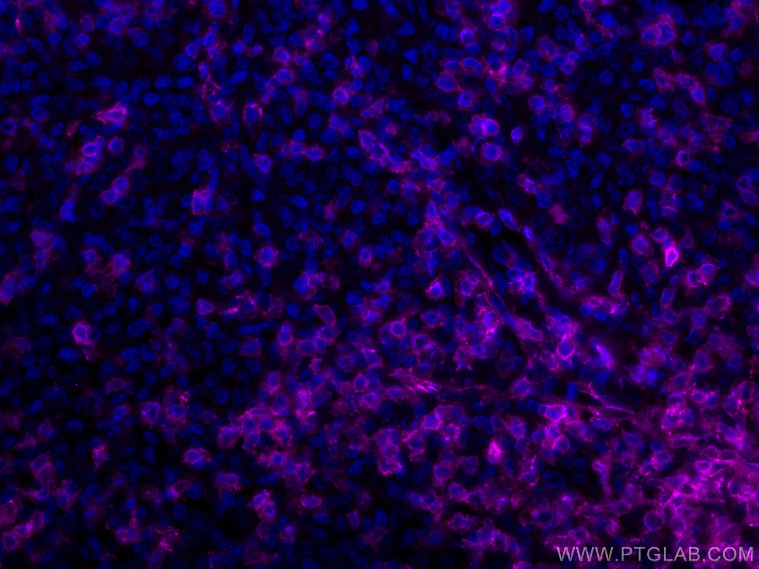 Immunofluorescence (IF) / fluorescent staining of human tonsillitis tissue using CoraLite® Plus 647-conjugated CD3 Monoclonal antib (CL647-60181)