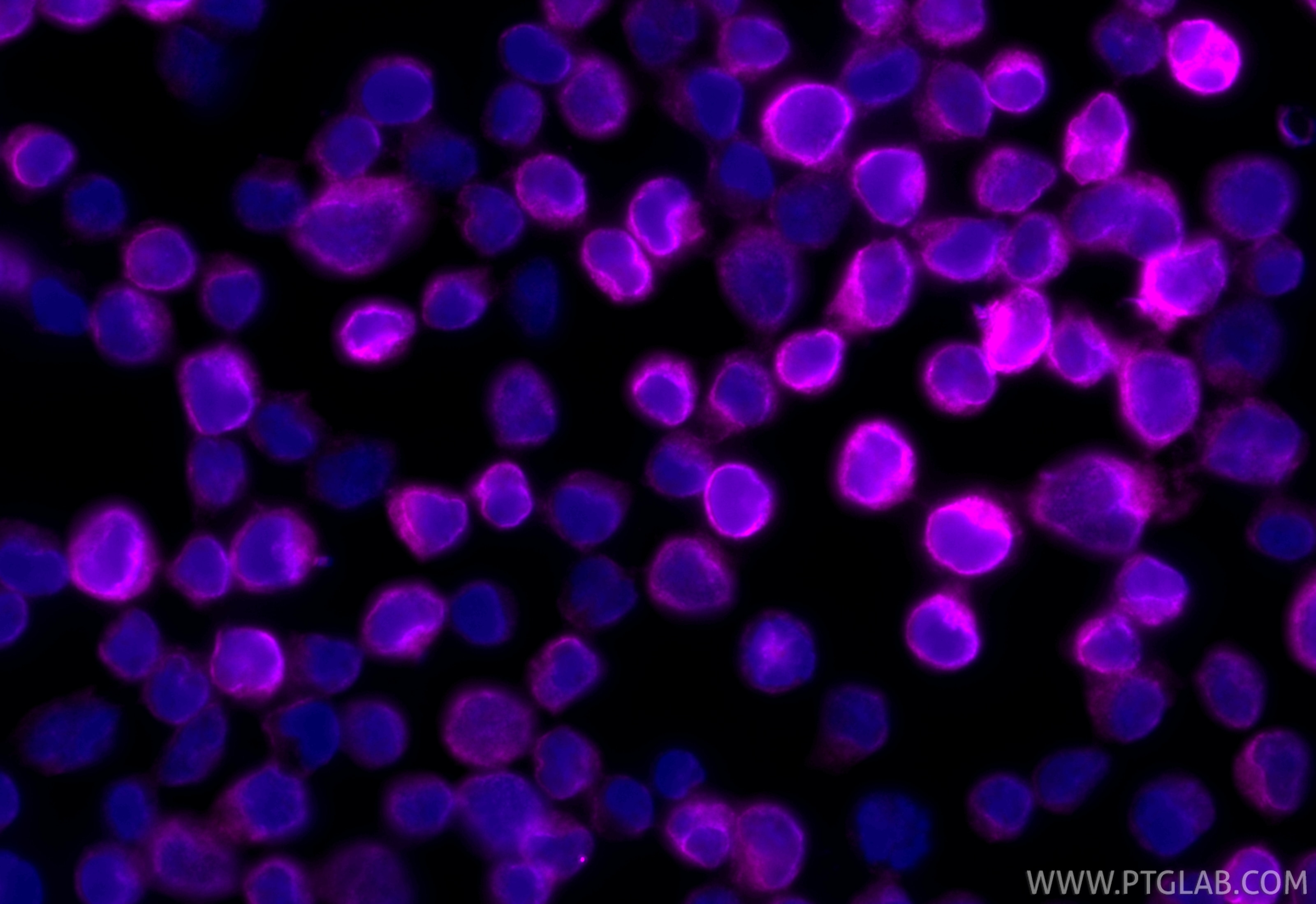 Immunofluorescence (IF) / fluorescent staining of Jurkat cells using CoraLite® Plus 647-conjugated CD3 Recombinant mono (CL647-84505-4)