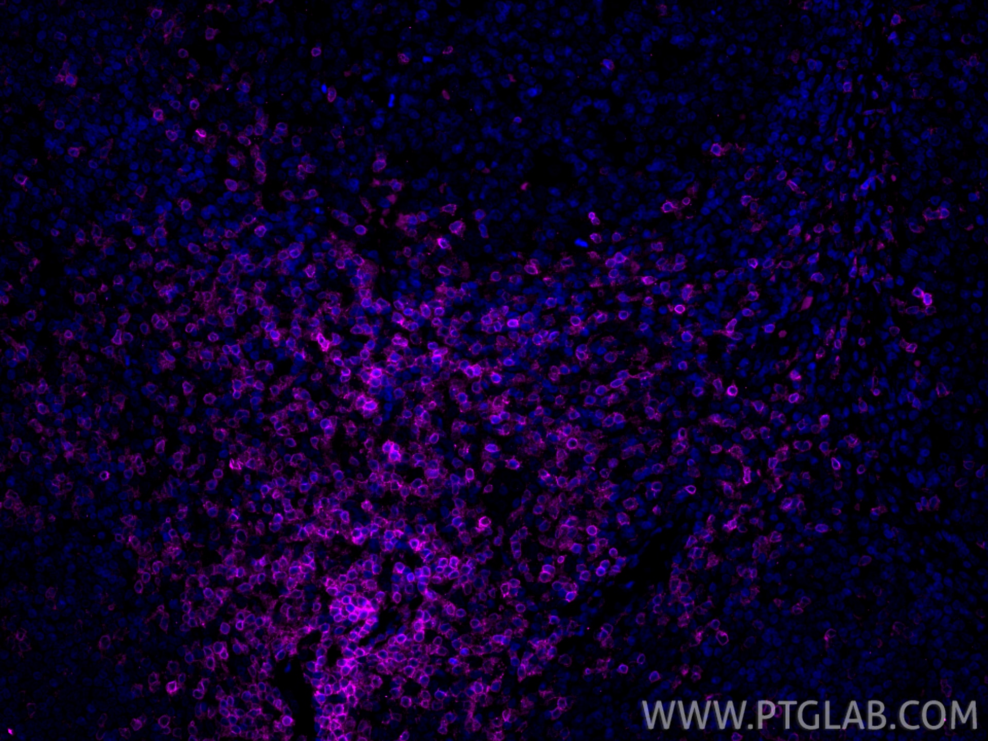 Immunofluorescence (IF) / fluorescent staining of human tonsillitis tissue using CoraLite® Plus 647-conjugated CD3 Recombinant mono (CL647-84505-4)