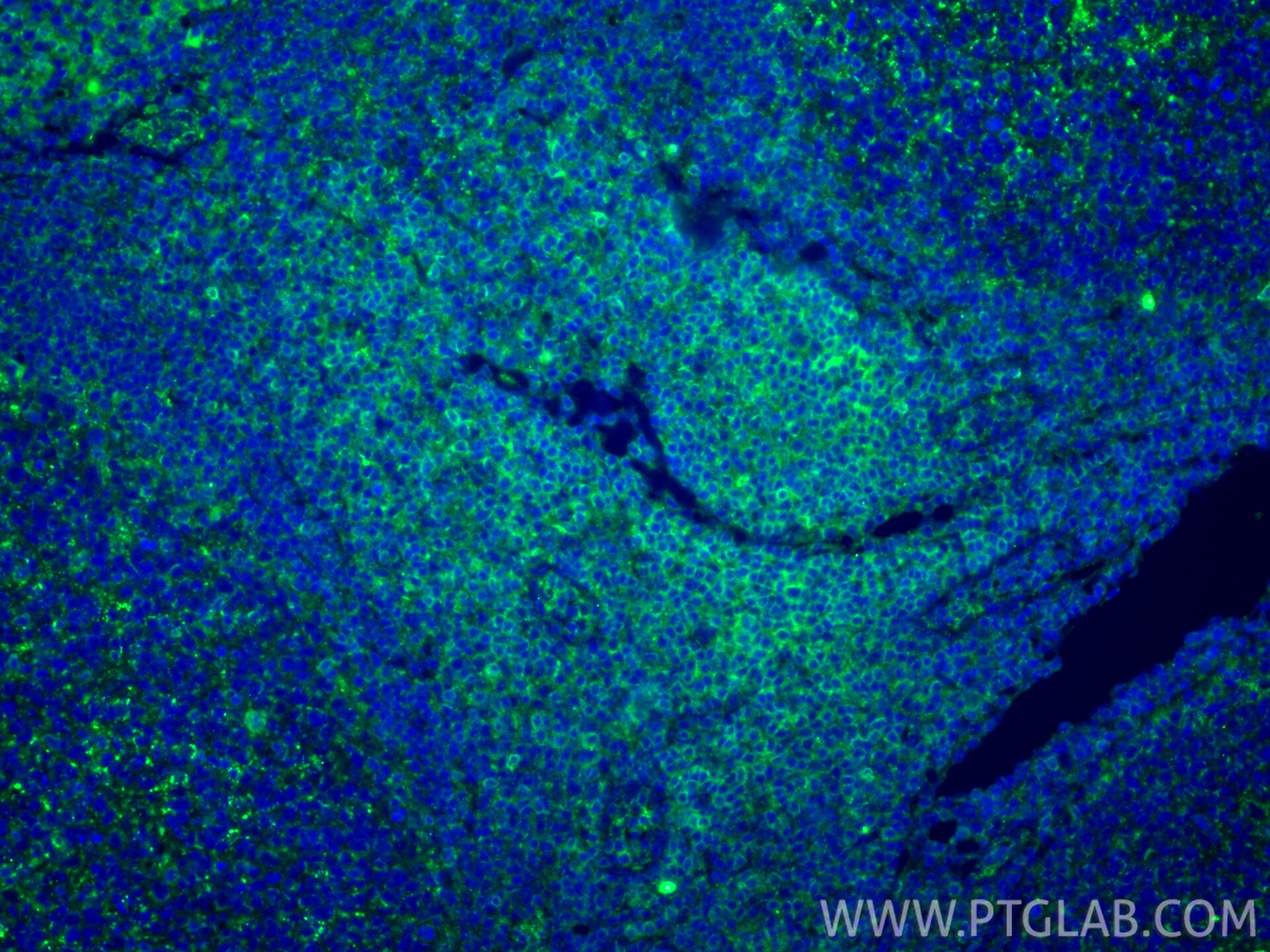 Immunofluorescent analysis of (4% PFA) fixed paraffin-embedded human tonsillitis tissue using CD3 Delta antibody (32144-1-AP) at dilution of 1:200 and CoraLite®488-Conjugated Goat Anti-Rabbit IgG(H+L) (SA00013-2). Heat mediated antigen retrieval with Tris-EDTA buffer (pH 9.0). Immunofluorescence (IF) / fluorescent staining of human tonsillitis tissue using CD3 Delta Polyclonal antibody (32144-1-AP)
