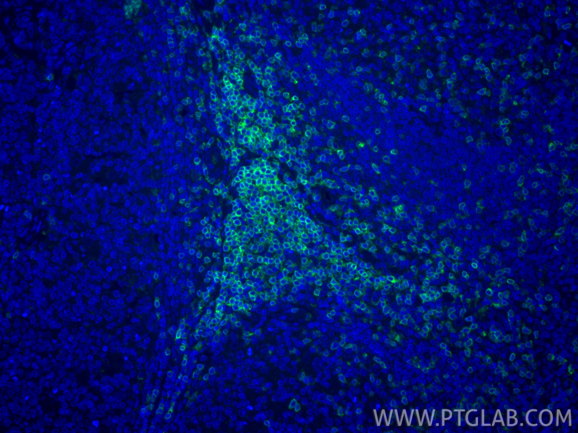 Immunofluorescent analysis of (4% PFA) fixed paraffin-embedded human tonsillitis tissue using CD3 Delta antibody (84214-4-RR, Clone: 241523H2 ) at dilution of 1:200 and CoraLite®488-Conjugated Goat Anti-Rabbit IgG(H+L) (SA00013-2). Heat mediated antigen retrieval with Tris-EDTA buffer (pH 9.0). This data was developed using the same antibody clone with 84214-4-PBS in a different storage buffer formulation. Immunofluorescence (IF) / fluorescent staining of human tonsillitis tissue using CD3 Delta Recombinant monoclonal antibody (84214-4-RR)
