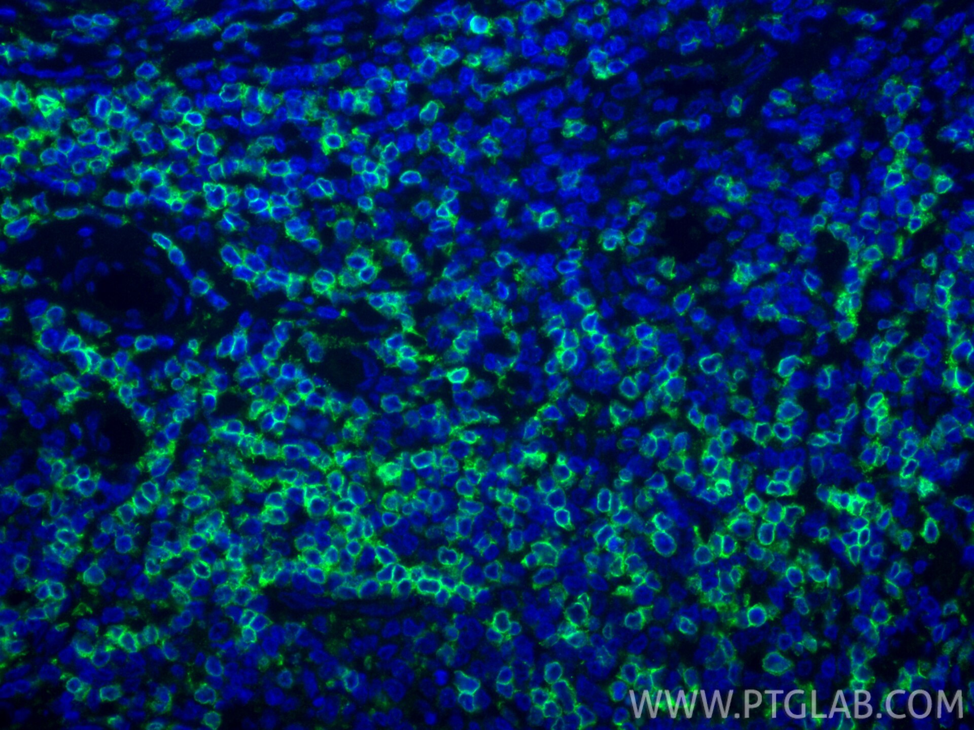 Immunofluorescent analysis of (4% PFA) fixed paraffin-embedded human tonsillitis tissue using CD3 Delta antibody (84214-4-RR, Clone: 241523H2 ) at dilution of 1:200 and CoraLite®488-Conjugated Goat Anti-Rabbit IgG(H+L) (SA00013-2). Heat mediated antigen retrieval with Tris-EDTA buffer (pH 9.0). This data was developed using the same antibody clone with 84214-4-PBS in a different storage buffer formulation. Immunofluorescence (IF) / fluorescent staining of human tonsillitis tissue using CD3 Delta Recombinant monoclonal antibody (84214-4-RR)