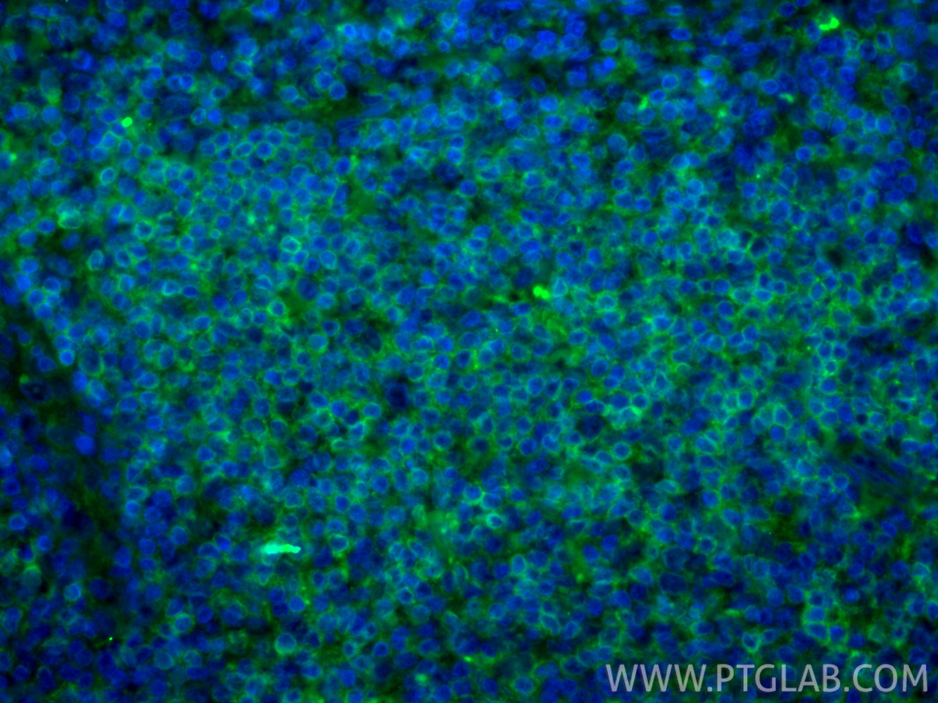 Immunofluorescent analysis of (4% PFA) fixed paraffin-embedded human tonsillitis tissue using CoraLite® Plus 488 CD3 Delta antibody (CL488-84214-4, Clone: 241523H2 ) at dilution of 1:200. Heat mediated antigen retrieval with Tris-EDTA buffer (pH 9.0). Immunofluorescence (IF) / fluorescent staining of human tonsillitis tissue using CoraLite® Plus 488-conjugated CD3 Delta Recombinan (CL488-84214-4)
