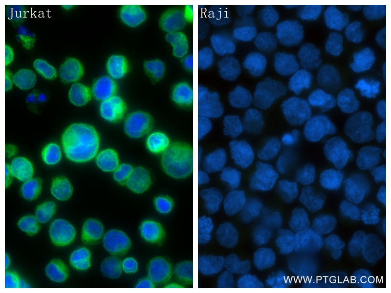 Immunofluorescence (IF) / fluorescent staining of Jurkat cells using CD3 Gamma Recombinant antibody (84836-1-RR)