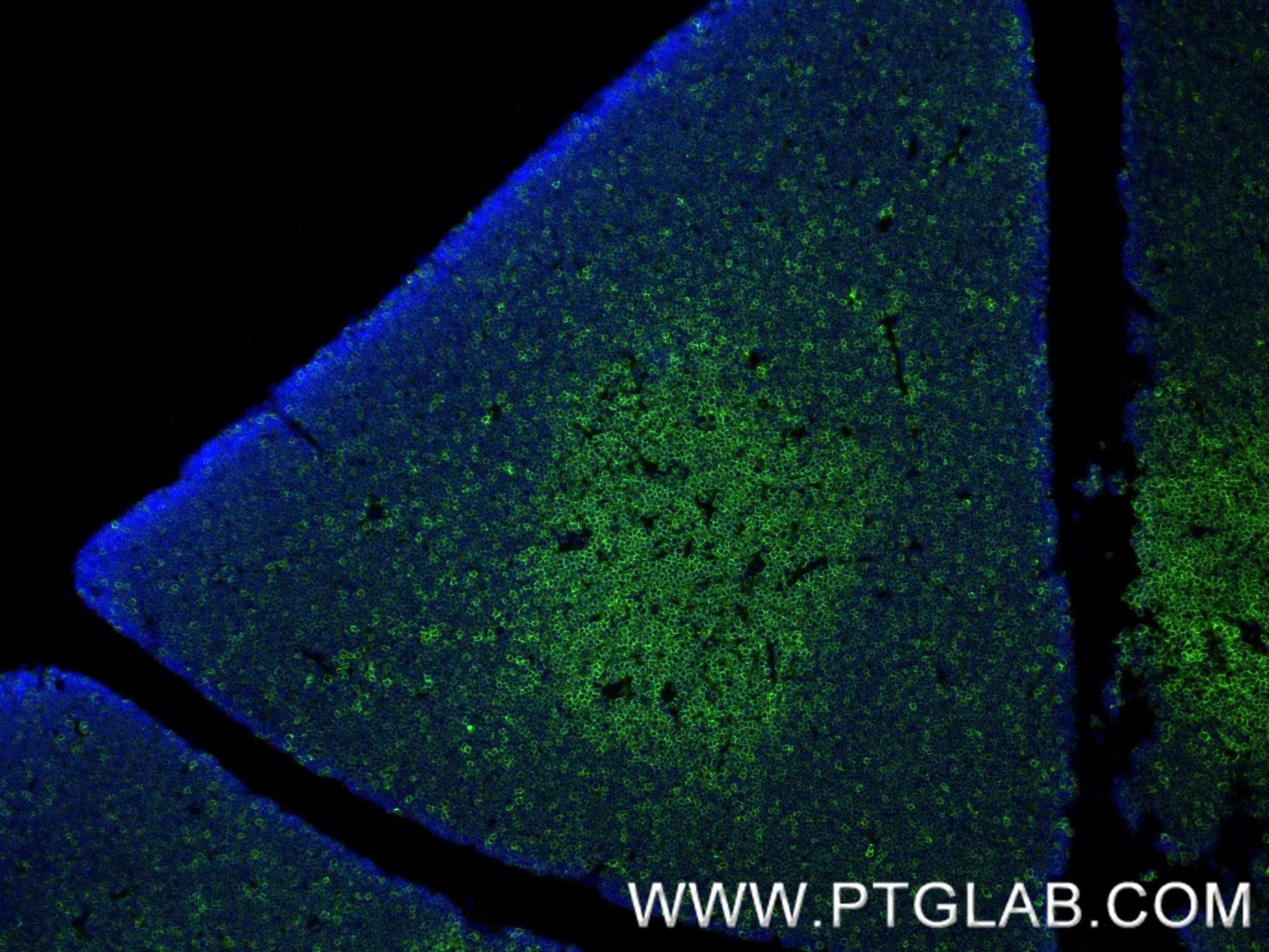 Immunofluorescence (IF) / fluorescent staining of rat thymus tissue using CD3 epsilon Recombinant monoclonal antibody (86053-1-RR)