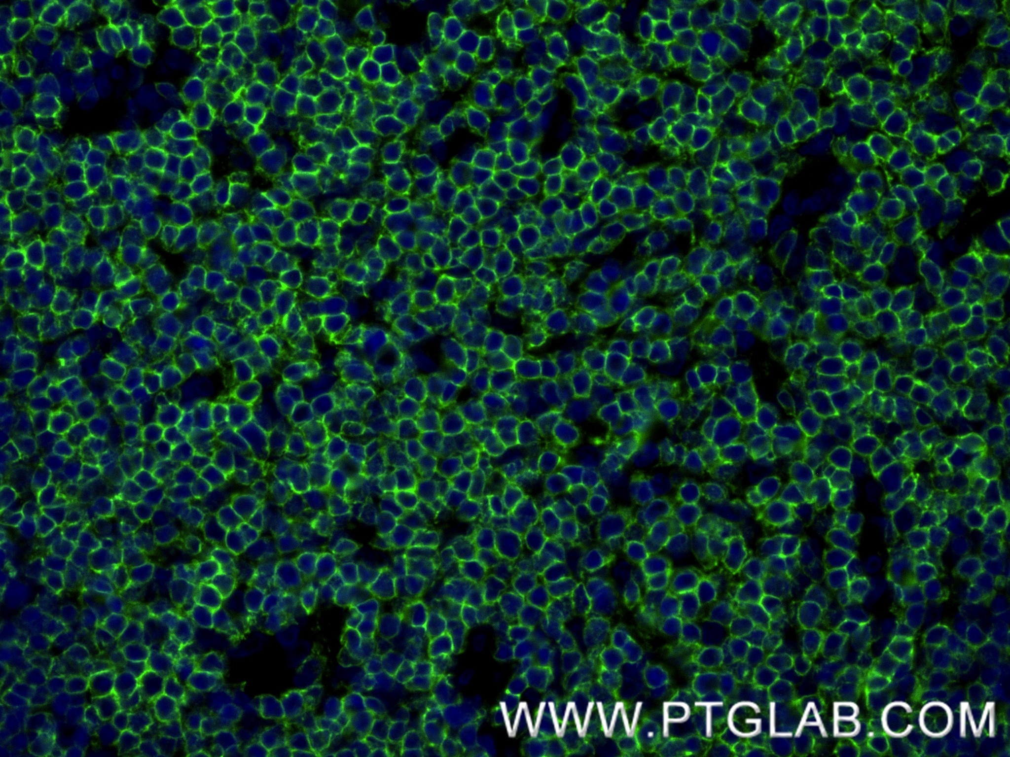 Immunofluorescence (IF) / fluorescent staining of rat thymus tissue using CD3 epsilon Recombinant monoclonal antibody (86053-1-RR)