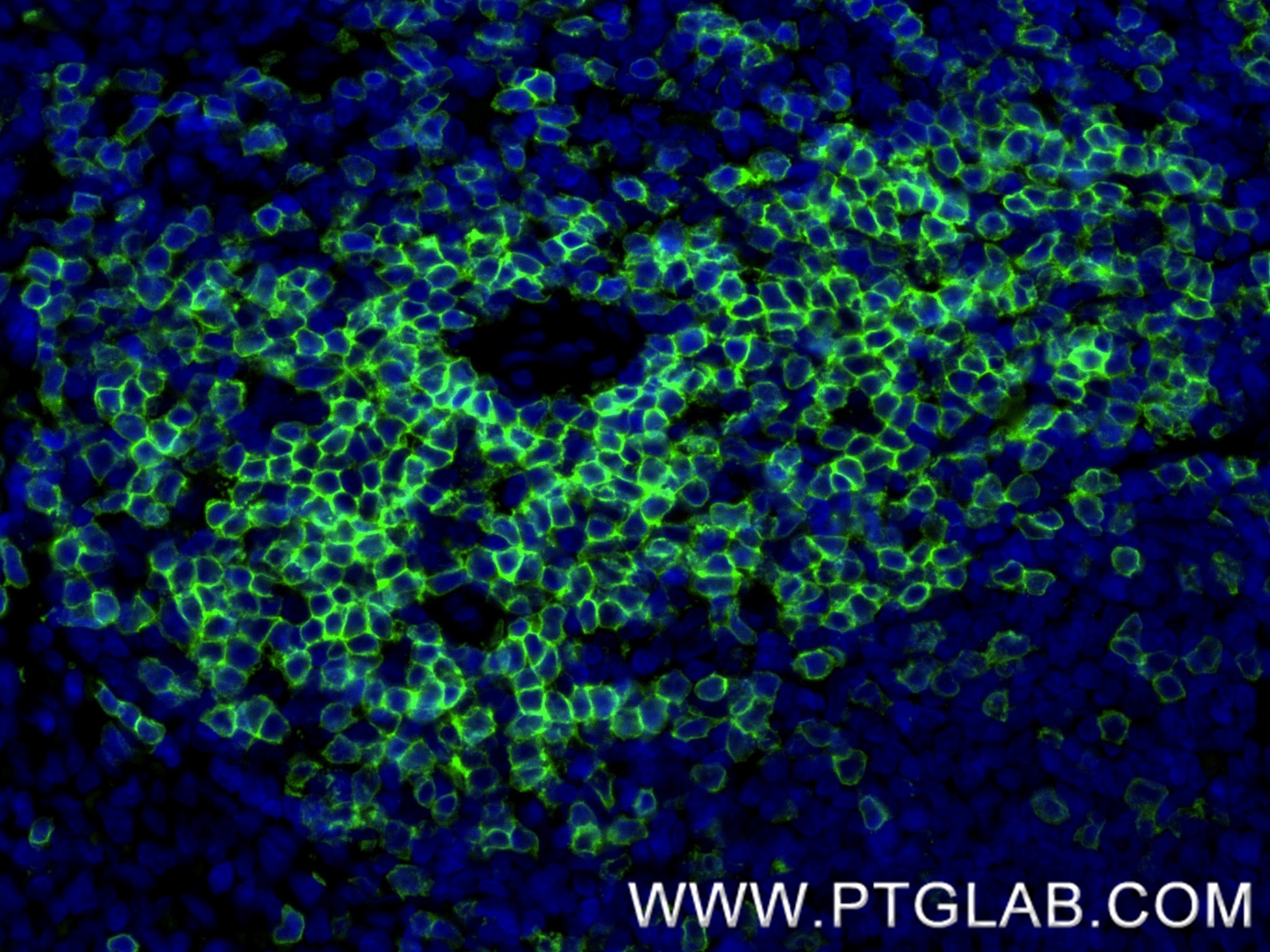 Immunofluorescence (IF) / fluorescent staining of rat spleen tissue using CD3 epsilon Recombinant monoclonal antibody (86053-1-RR)