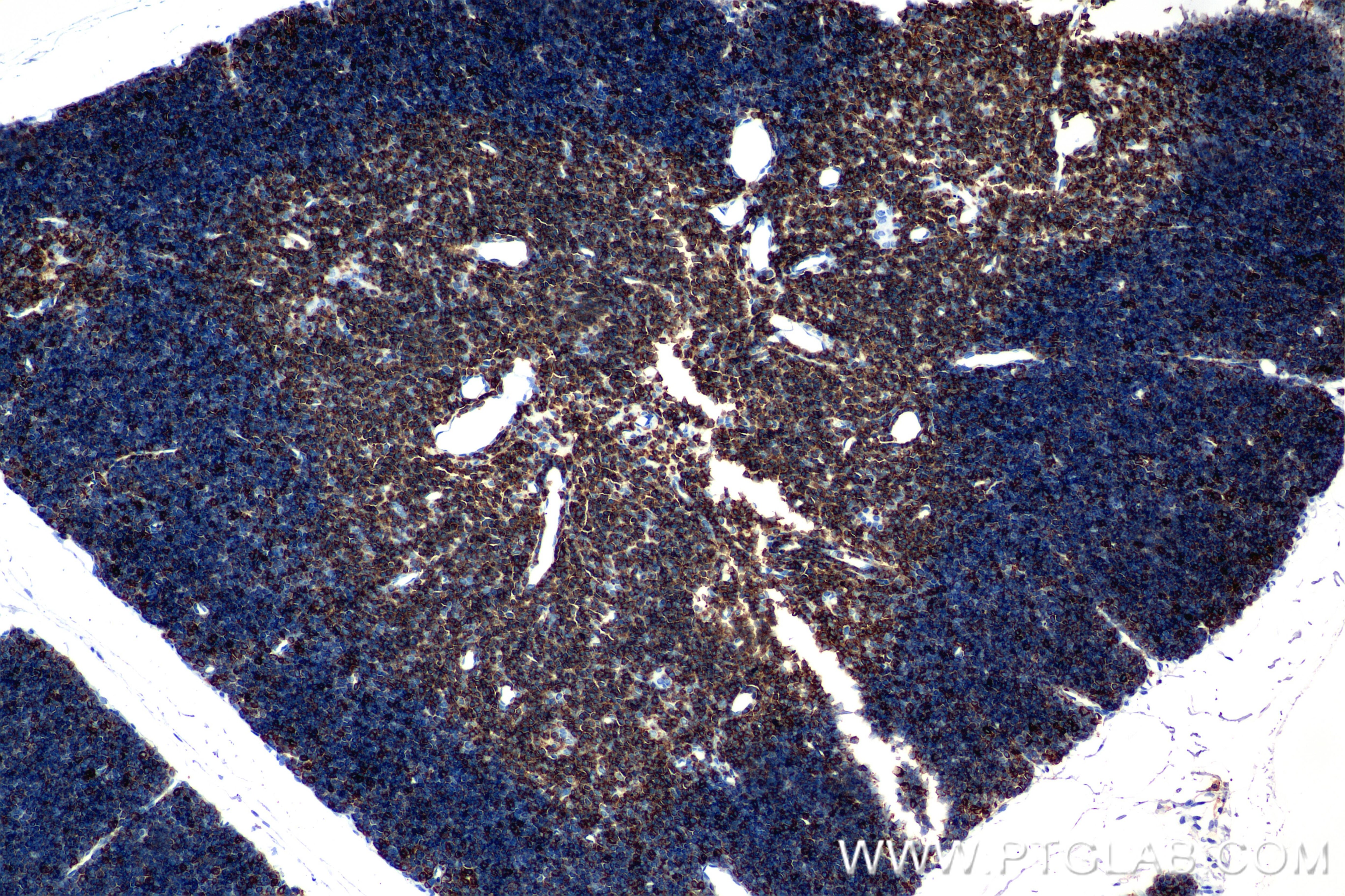 Immunohistochemistry (IHC) staining of rat thymus tissue using CD3 epsilon Recombinant monoclonal antibody (86053-1-RR)