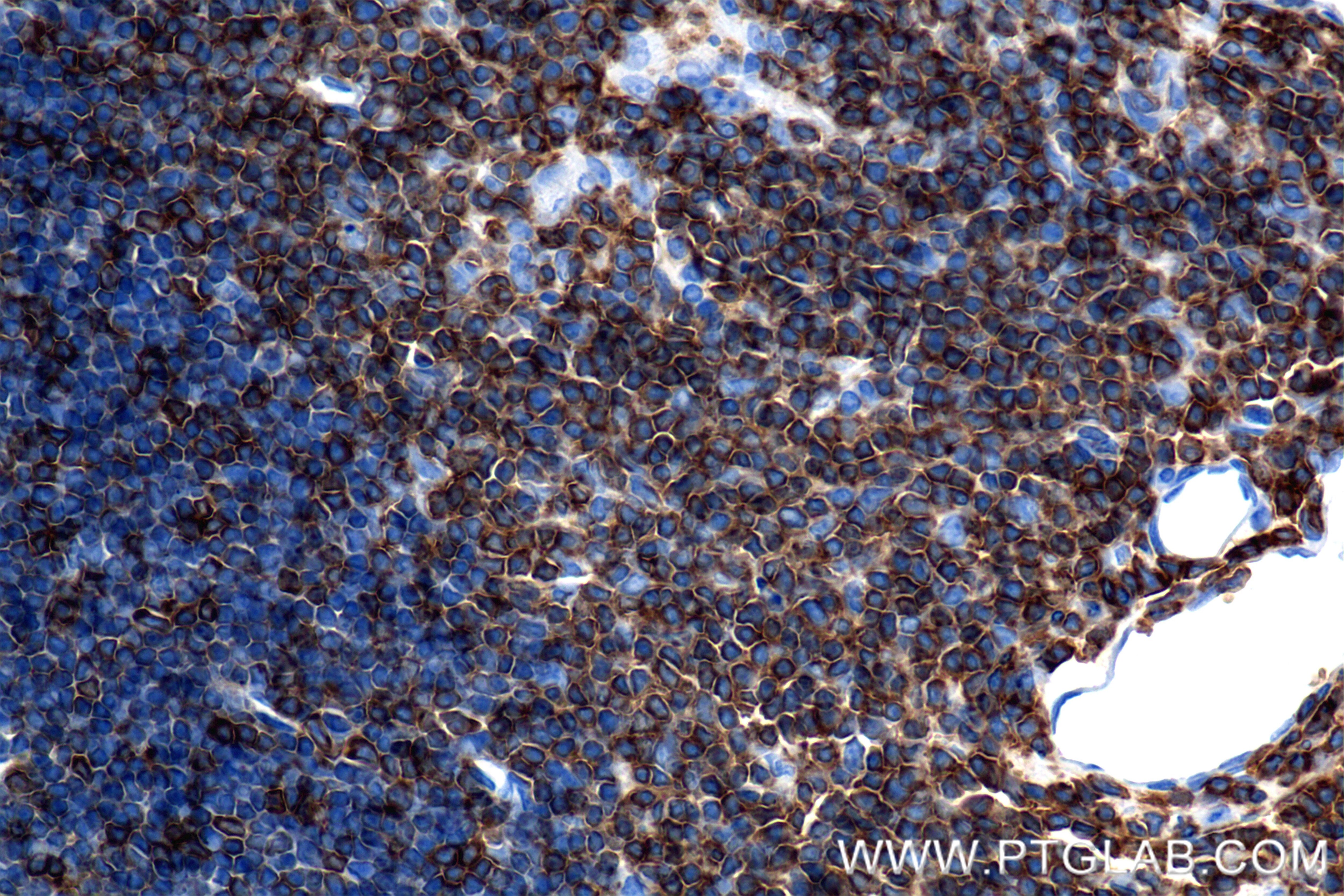 Immunohistochemistry (IHC) staining of rat thymus tissue using CD3 epsilon Recombinant monoclonal antibody (86053-1-RR)
