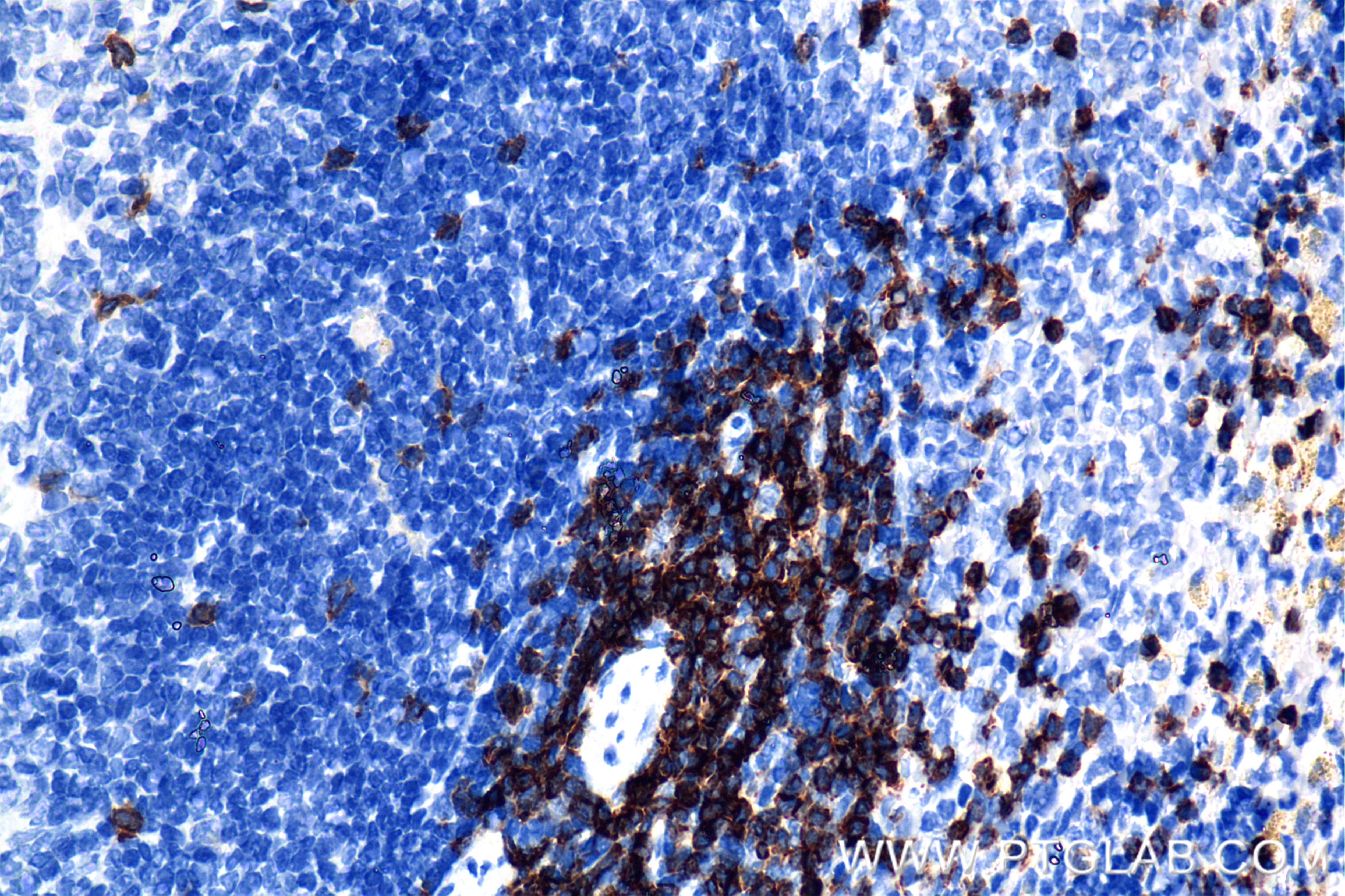 Immunohistochemistry (IHC) staining of rat spleen tissue using CD3 epsilon Recombinant monoclonal antibody (86053-1-RR)