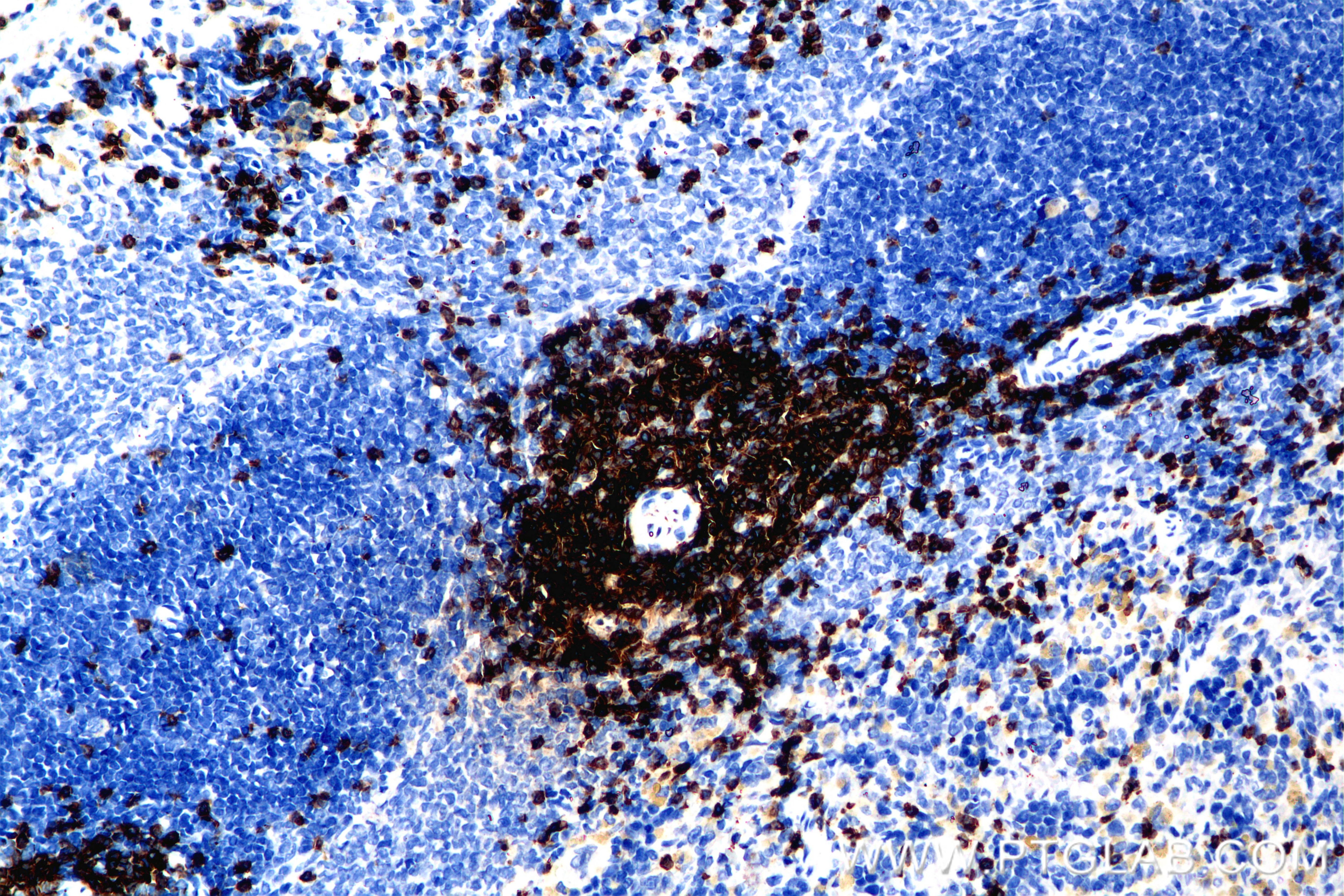 Immunohistochemistry (IHC) staining of rat spleen tissue using CD3 epsilon Recombinant monoclonal antibody (86053-1-RR)