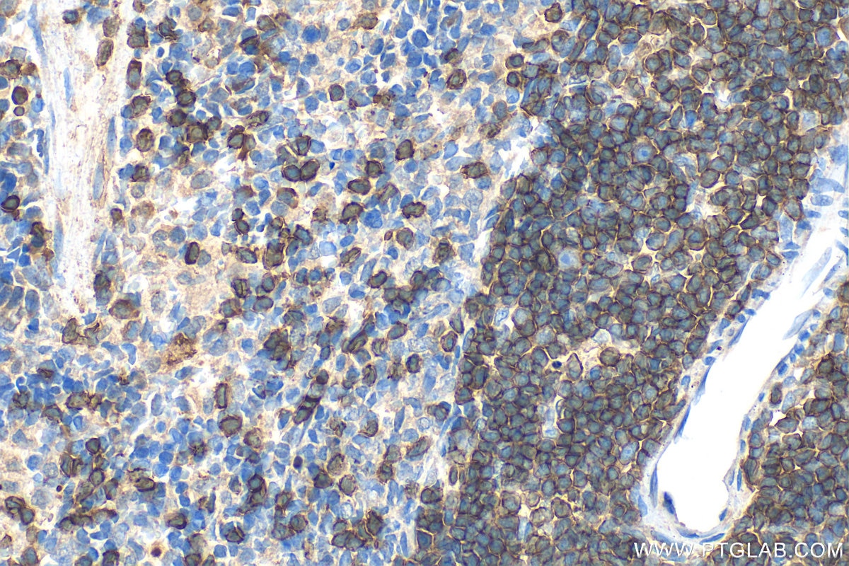 Immunohistochemistry (IHC) staining of rat spleen tissue using CD3 epsilon Polyclonal antibody (31889-1-AP)