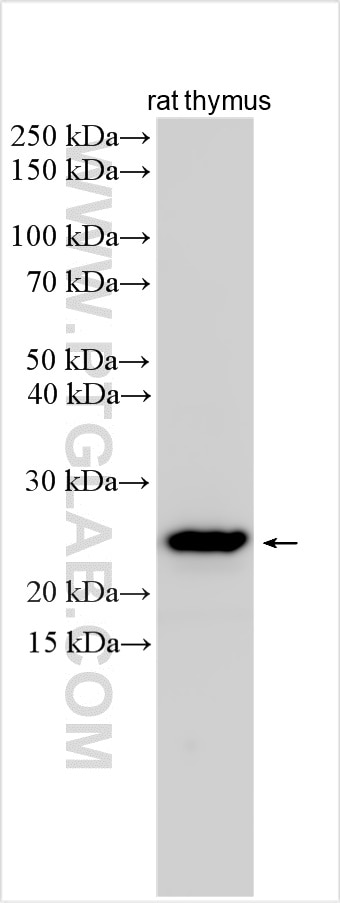 Western Blot (WB) analysis of various lysates using CD3 epsilon/CD3e Polyclonal antibody (31889-1-AP)