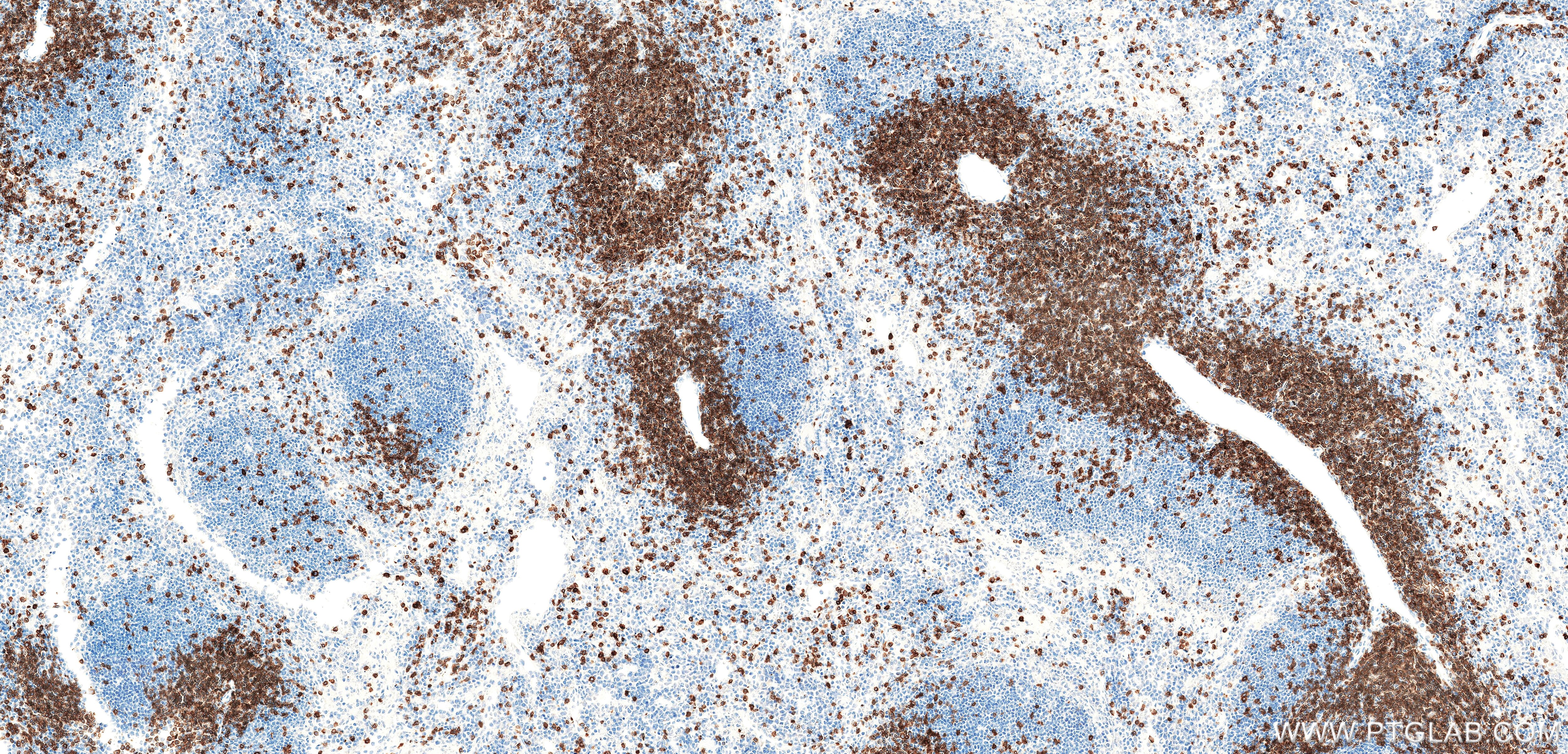 IHC staining of mouse spleen using 87861-1-RR Immunohistochemistry (IHC) staining of mouse spleen tissue using CD3 gamma Recombinant monoclonal antibody (87861-1-RR)