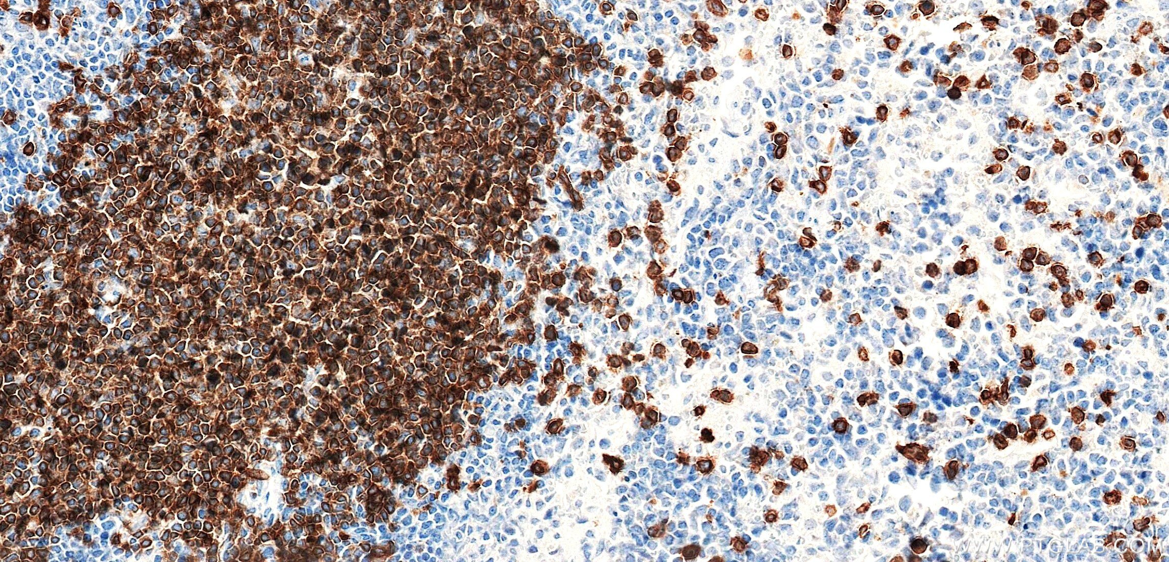 IHC staining of mouse spleen using 87861-1-RR Immunohistochemistry (IHC) staining of mouse spleen tissue using CD3 gamma Recombinant monoclonal antibody (87861-1-RR)