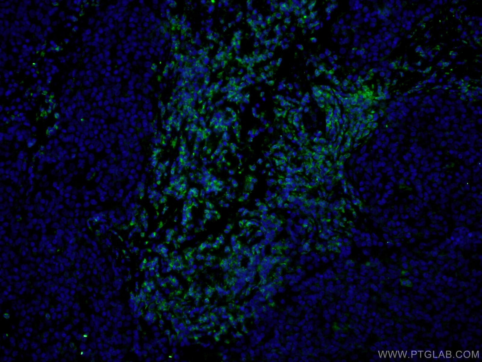 Immunofluorescence (IF) / fluorescent staining of human tonsillitis tissue using CoraLite® Plus 488-conjugated CD3 Gamma Monoclonal (CL488-60347)