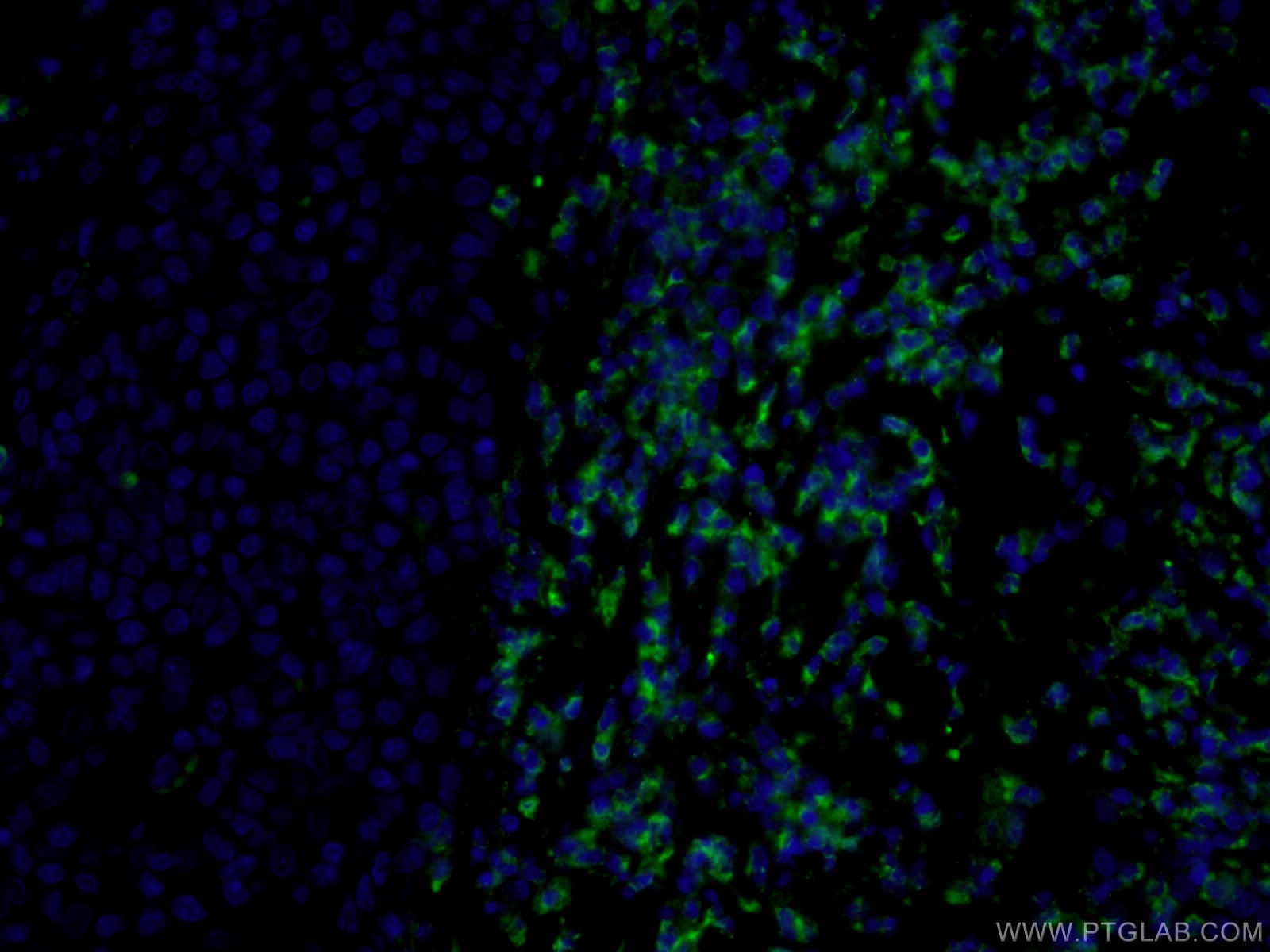 Immunofluorescence (IF) / fluorescent staining of human tonsillitis tissue using CoraLite® Plus 488-conjugated CD3 Gamma Monoclonal (CL488-60347)