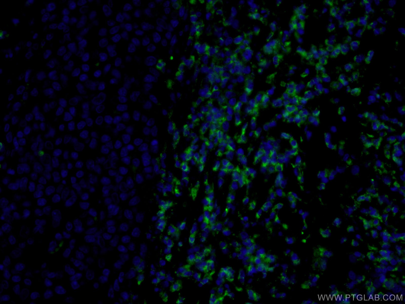 IF Staining of human tonsillitis using CL488-60347