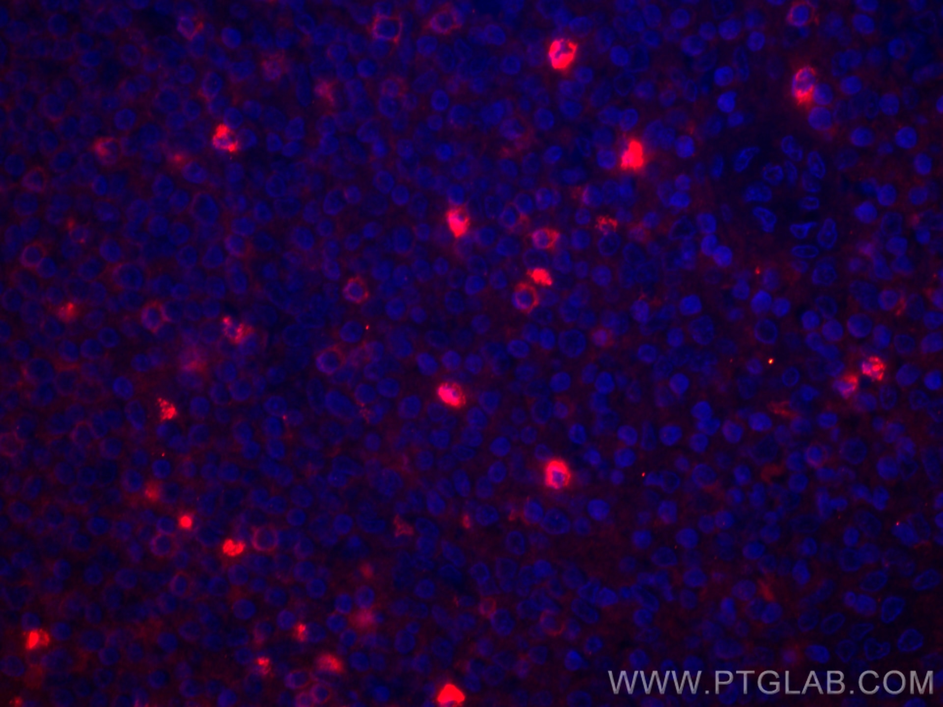 Immunofluorescence (IF) / fluorescent staining of human tonsillitis tissue using CoraLite®594-conjugated CD3 gamma Monoclonal antib (CL594-60347)