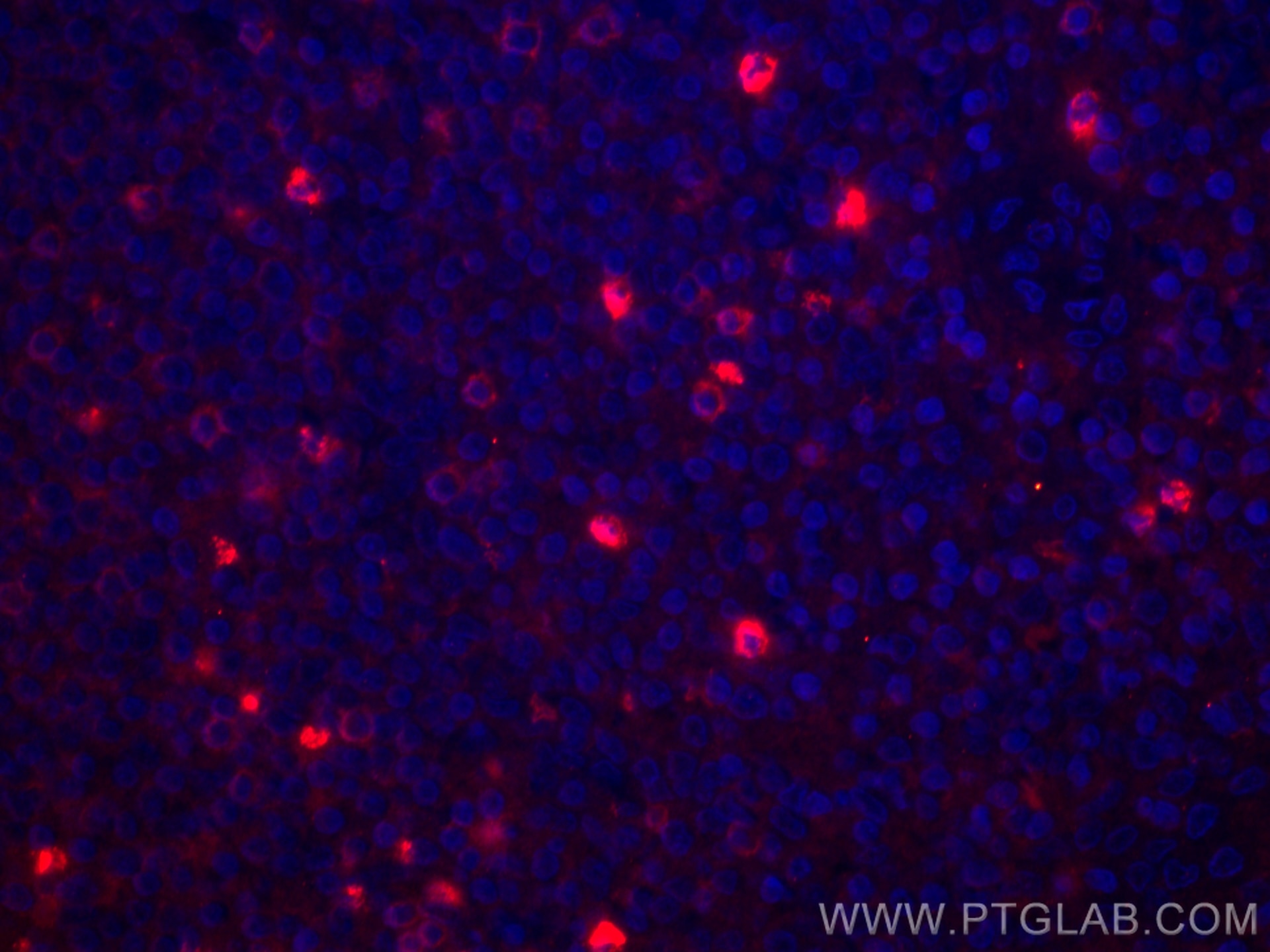Immunofluorescence (IF) / fluorescent staining of human tonsillitis tissue using CoraLite®594-conjugated CD3 gamma Monoclonal antib (CL594-60347)