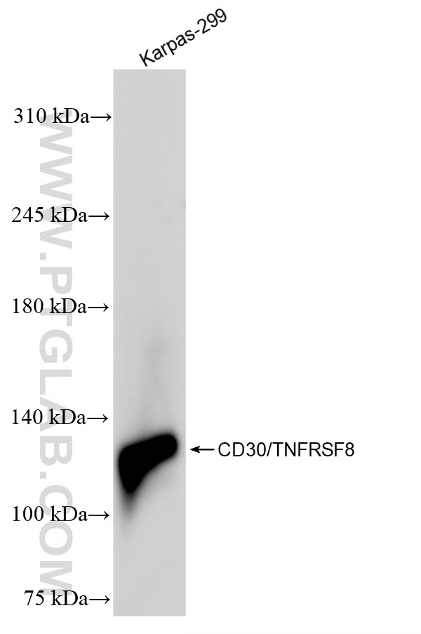 Western Blot (WB) analysis of Karpas-299 cells using CD30/TNFRSF8 Recombinant antibody (84241-2-RR)