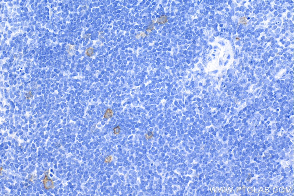 Immunohistochemistry (IHC) staining of mouse spleen tissue using CD30/TNFRSF8 Recombinant antibody (84420-6-RR)