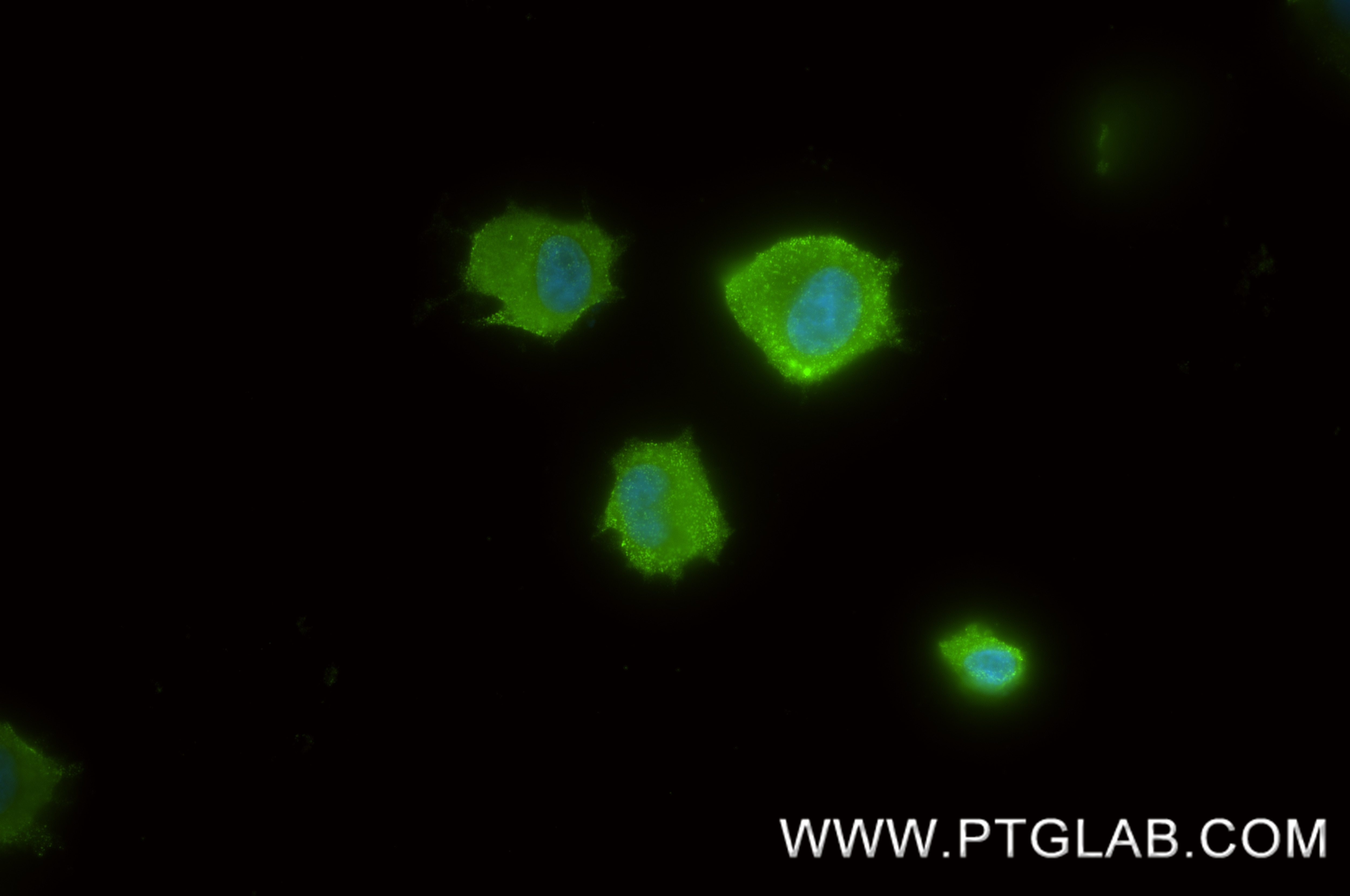 IF Staining of PC-12 using 87467-3-RR Immunofluorescence (IF) / fluorescent staining of PC-12 cells using CD30/TNFRSF8 Recombinant monoclonal antibody (87467-3-RR)