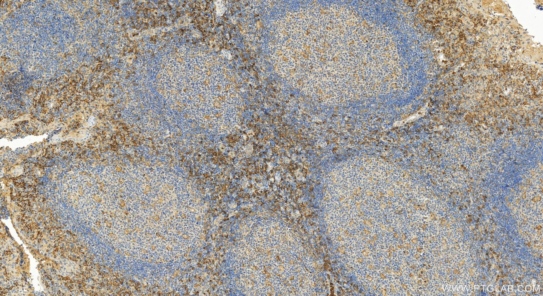 Immunohistochemistry (IHC) staining of human tonsillitis tissue using CD300C Polyclonal antibody (32141-1-AP)