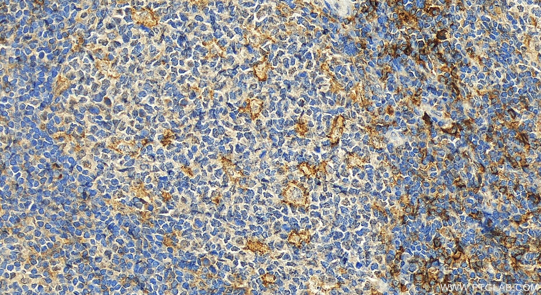 Immunohistochemistry (IHC) staining of human tonsillitis tissue using CD300C Polyclonal antibody (32141-1-AP)