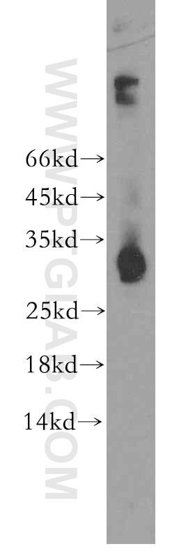 WB analysis of U-937 using 13334-1-AP