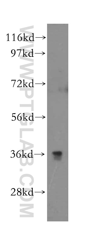 WB analysis of HepG2 using 15426-1-AP