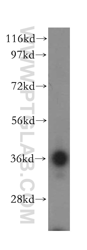 Western Blot (WB) analysis of human kidney tissue using CD300LG Polyclonal antibody (15426-1-AP)
