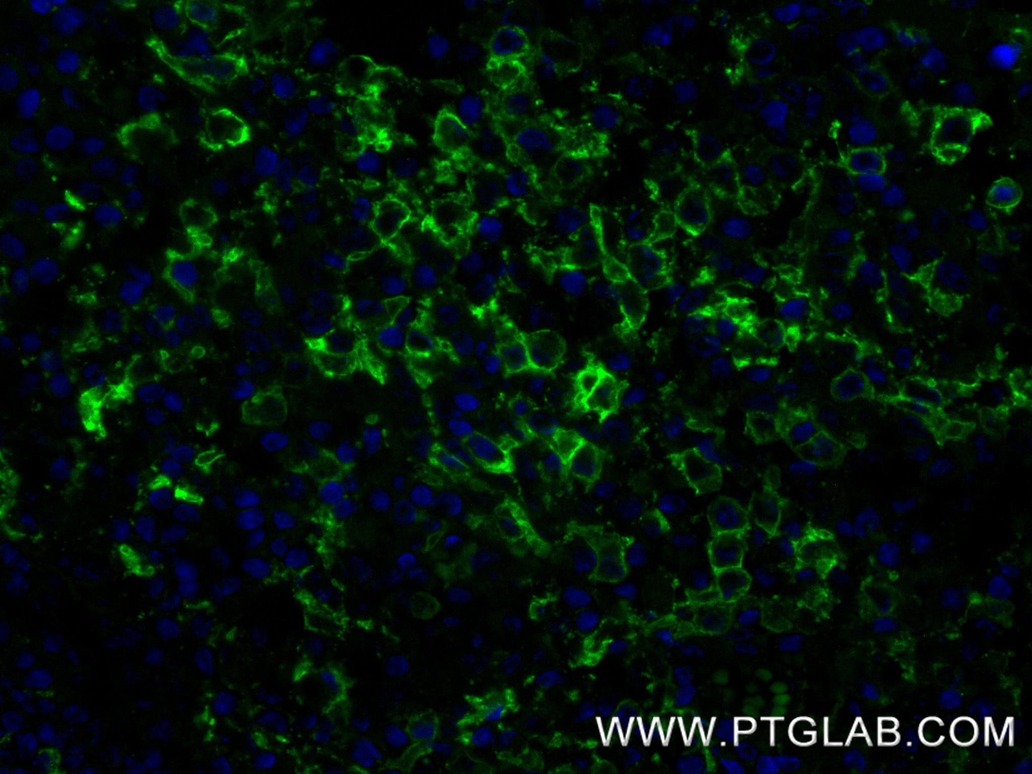 IF Staining of human tonsillitis using 87497-1-RR Immunofluorescence (IF) / fluorescent staining of human tonsillitis tissue using CD300f Recombinant monoclonal antibody (87497-1-RR)
