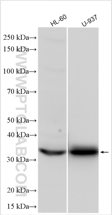 Western Blot (WB) analysis of various lysates using CD302 Polyclonal antibody (16472-1-AP)