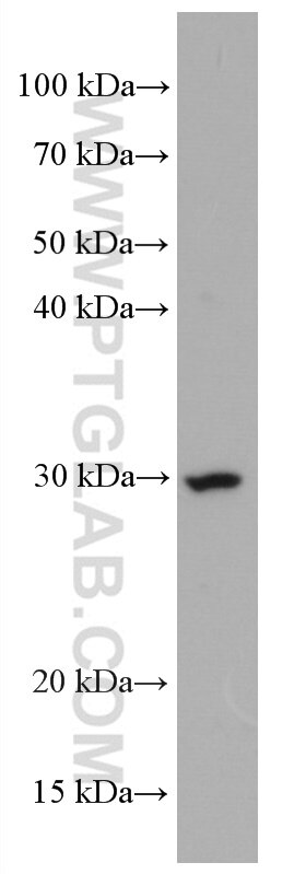 Western Blot (WB) analysis of THP-1 cells using CD302 Monoclonal antibody (66640-1-Ig)