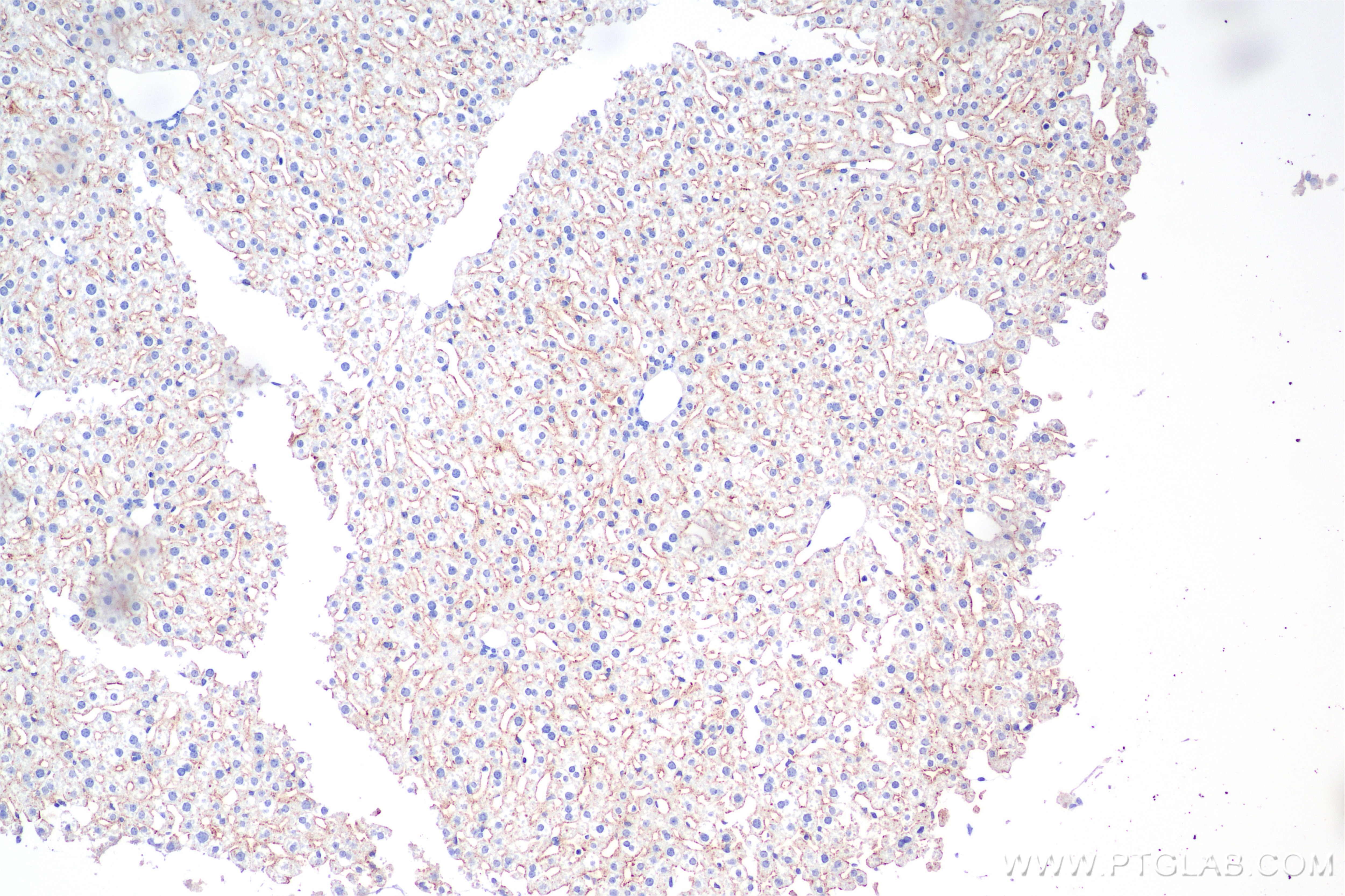 Immunohistochemistry (IHC) staining of mouse liver tissue using CD302 Recombinant antibody (85813-5-RR)