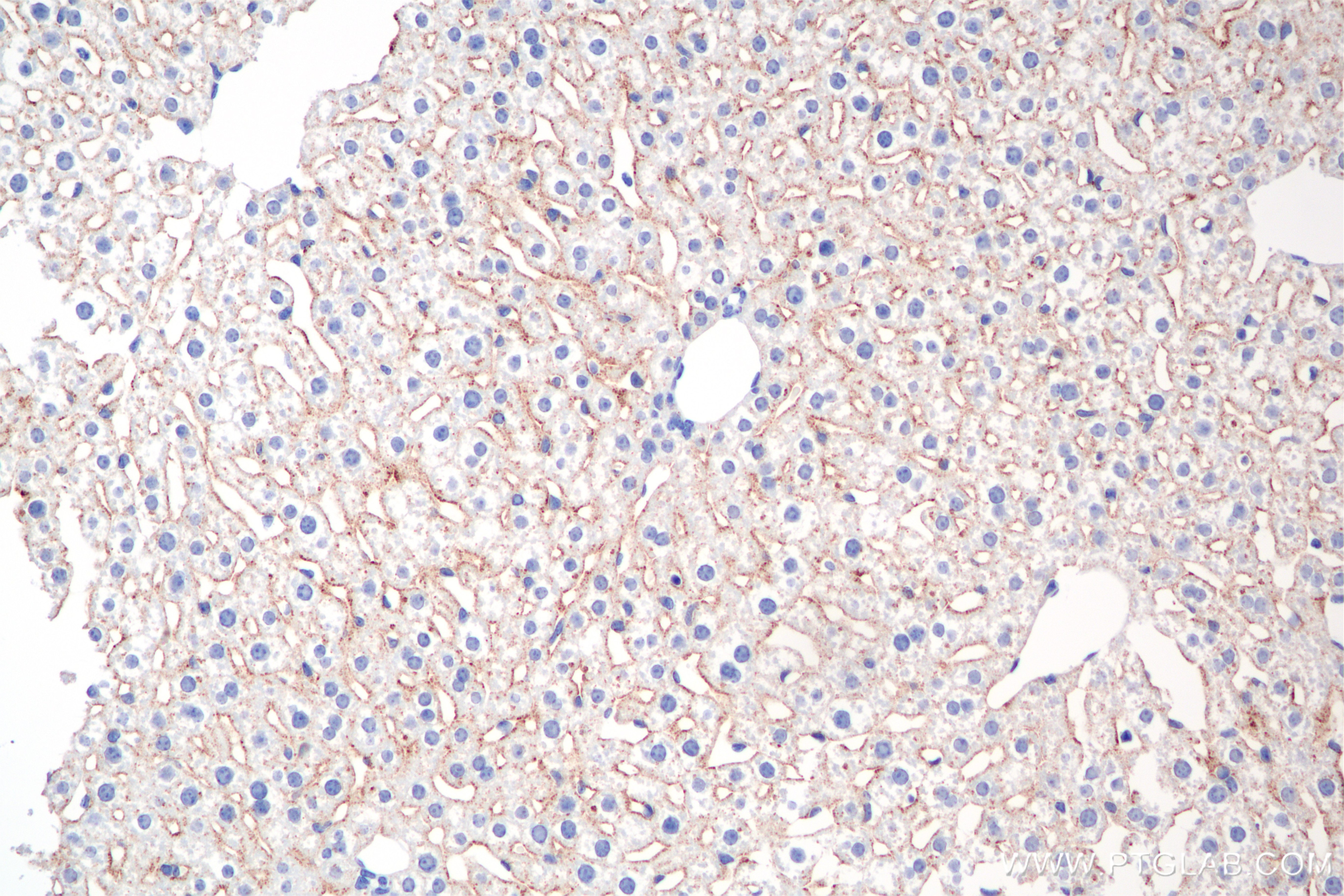 Immunohistochemistry (IHC) staining of mouse liver tissue using CD302 Recombinant antibody (85813-5-RR)