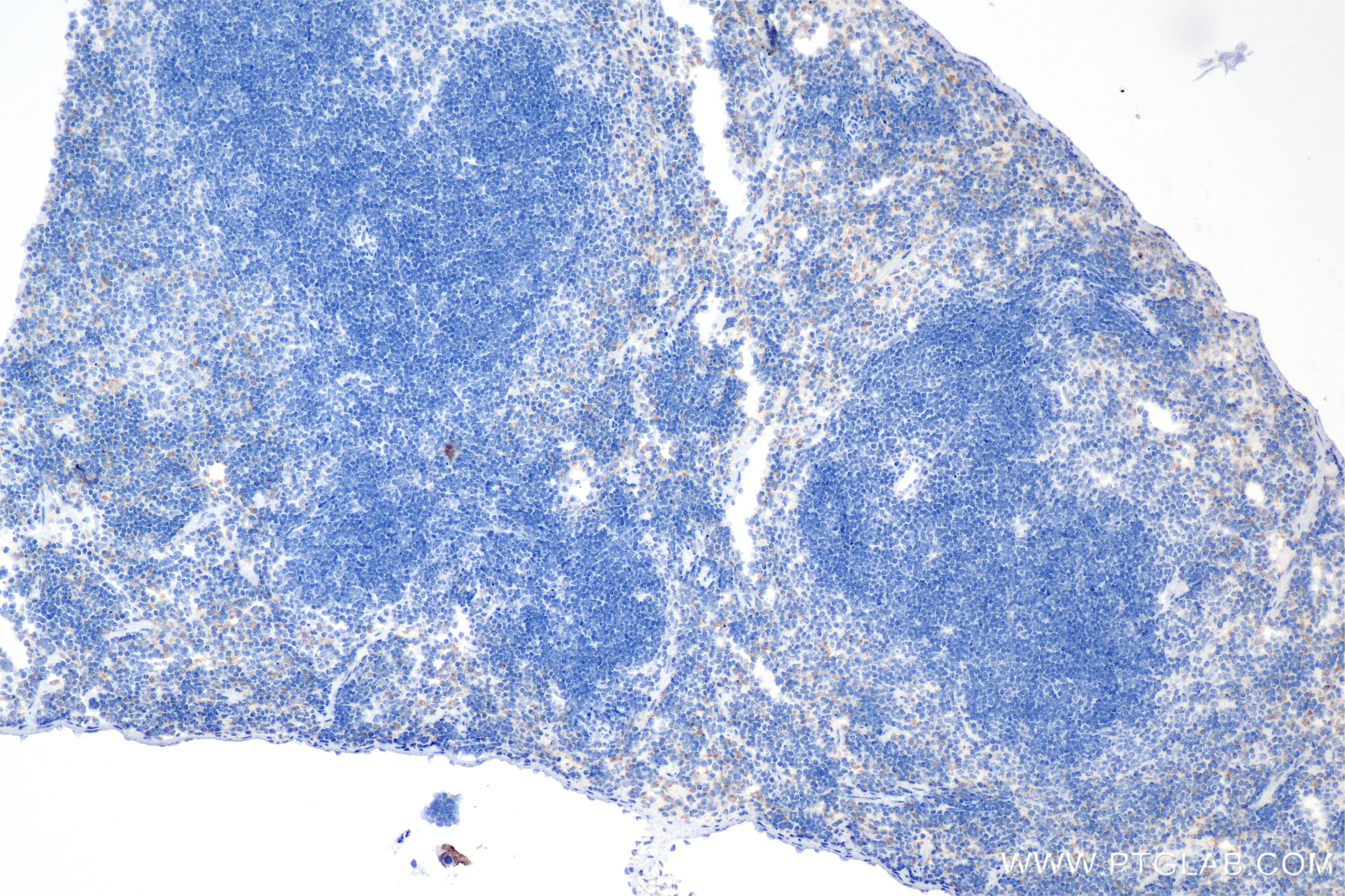 Immunohistochemistry (IHC) staining of mouse spleen tissue using CD302 Recombinant antibody (85813-5-RR)
