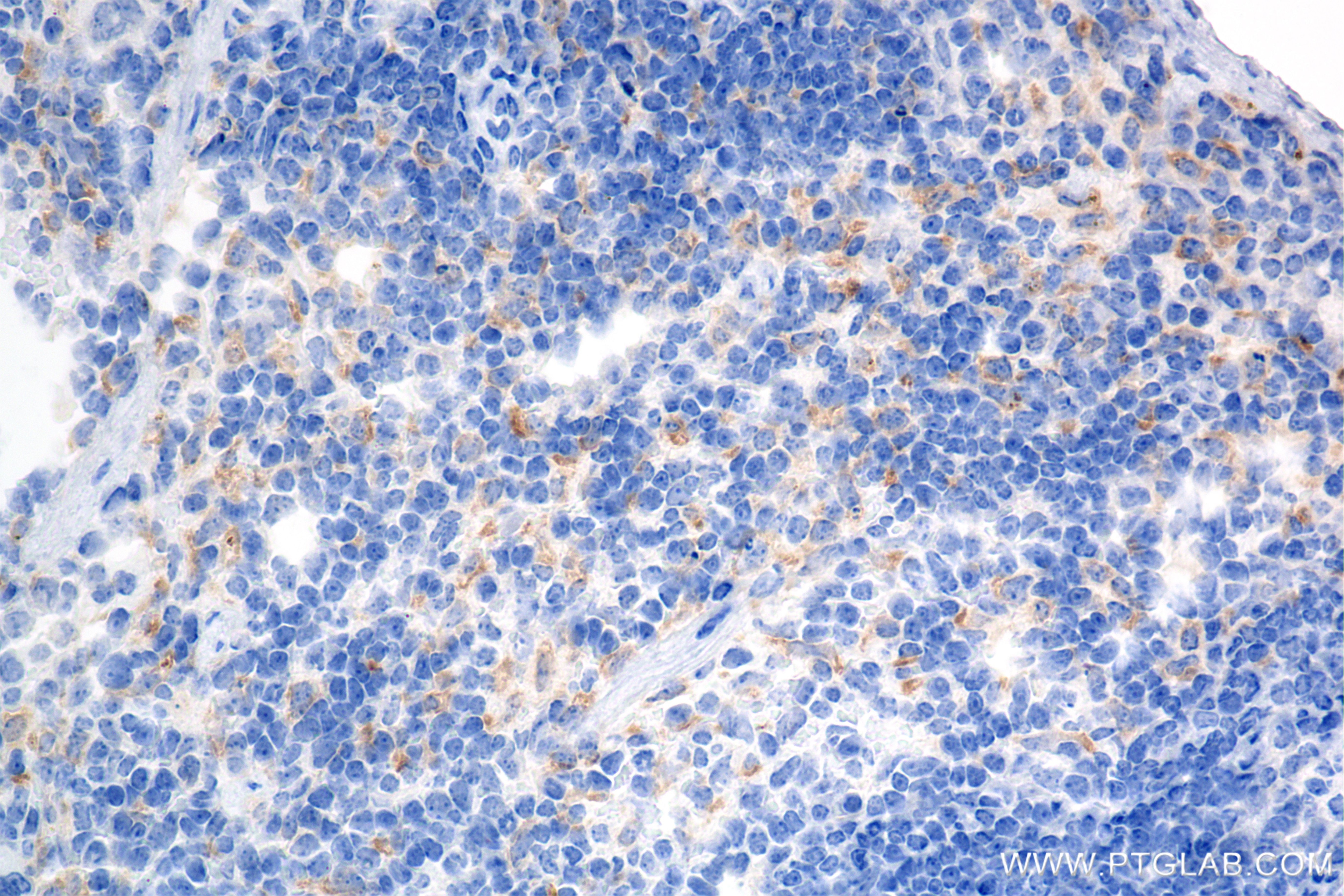 Immunohistochemistry (IHC) staining of mouse spleen tissue using CD302 Recombinant antibody (85813-5-RR)